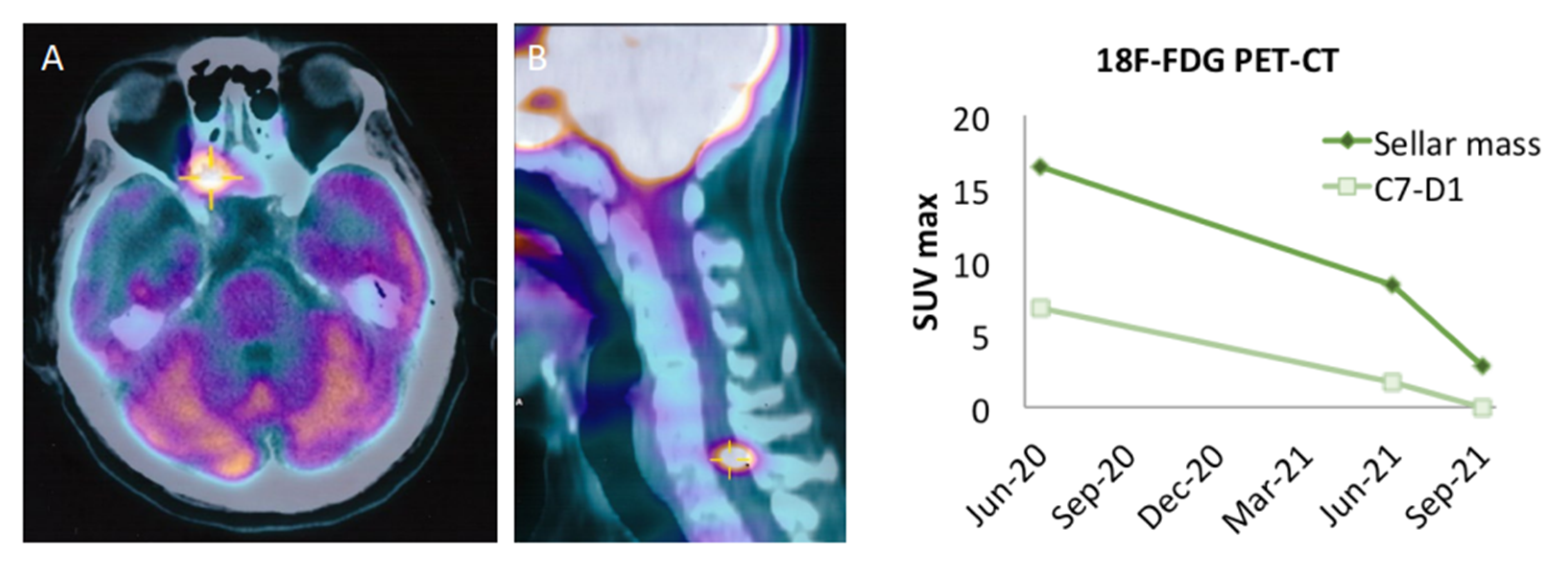 Cancers 14 04093 g004 Cancers 14 04093 g004