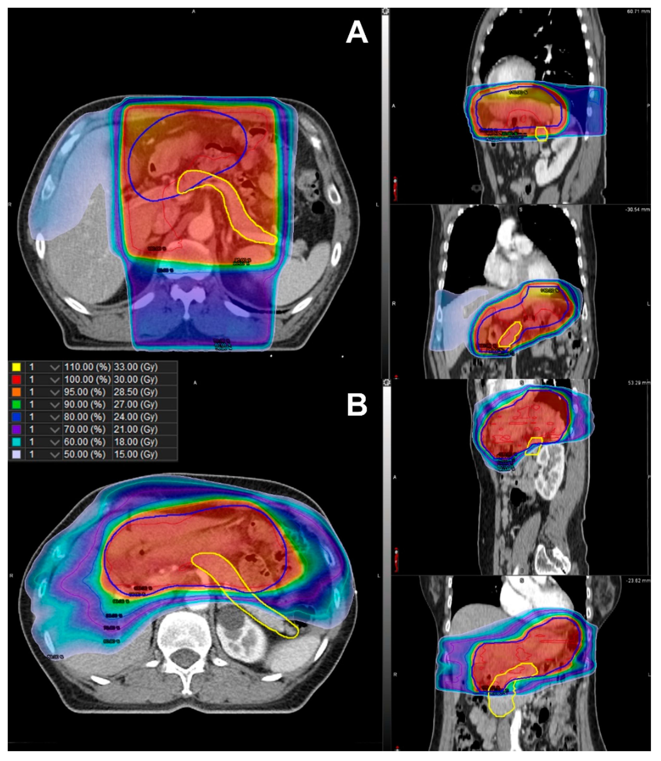 Cancers 14 04110 g003 550