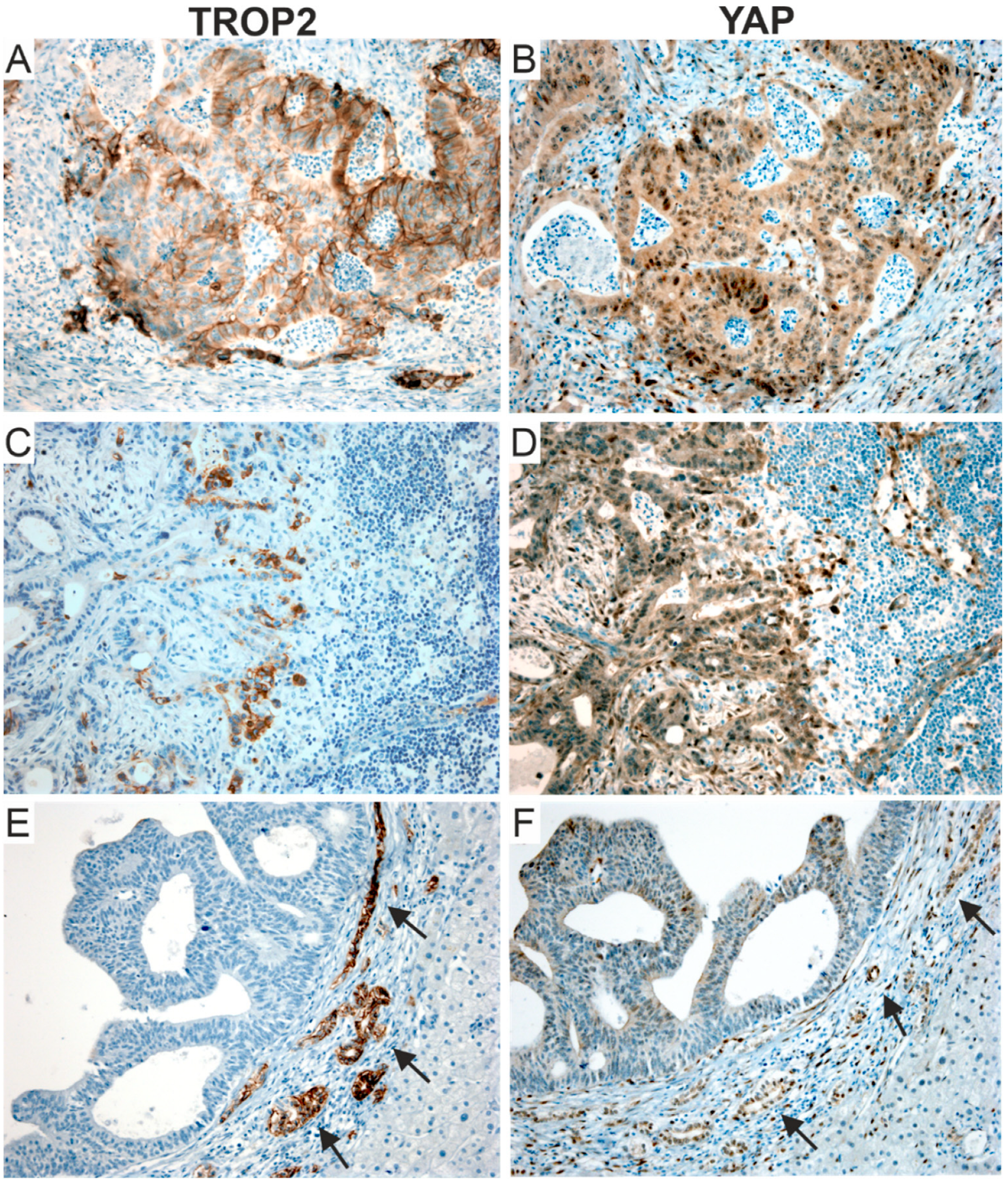 Cancers 14 04137 g009 Cancers 14 04137 g009