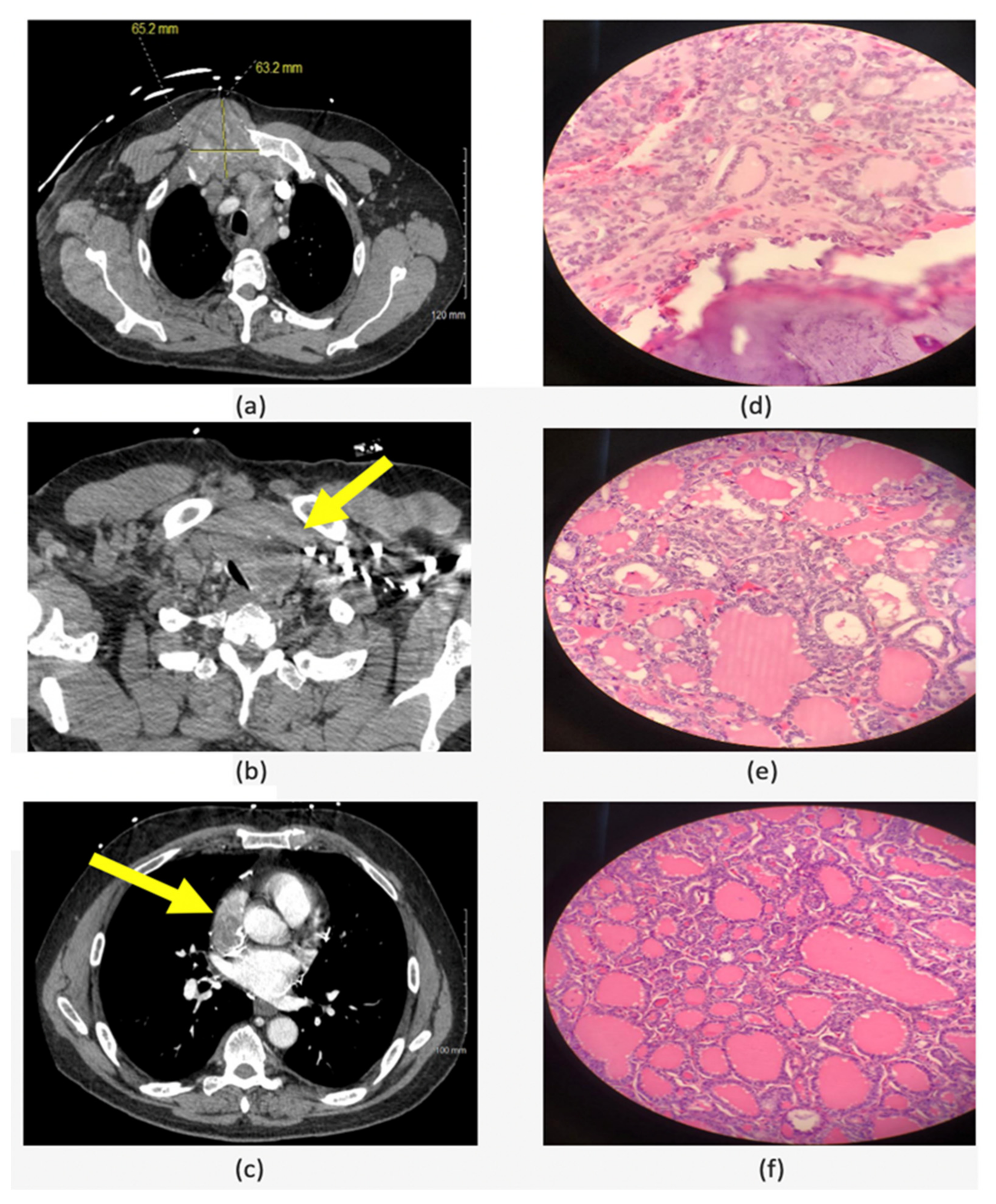 Cancers 14 04140 g003 550