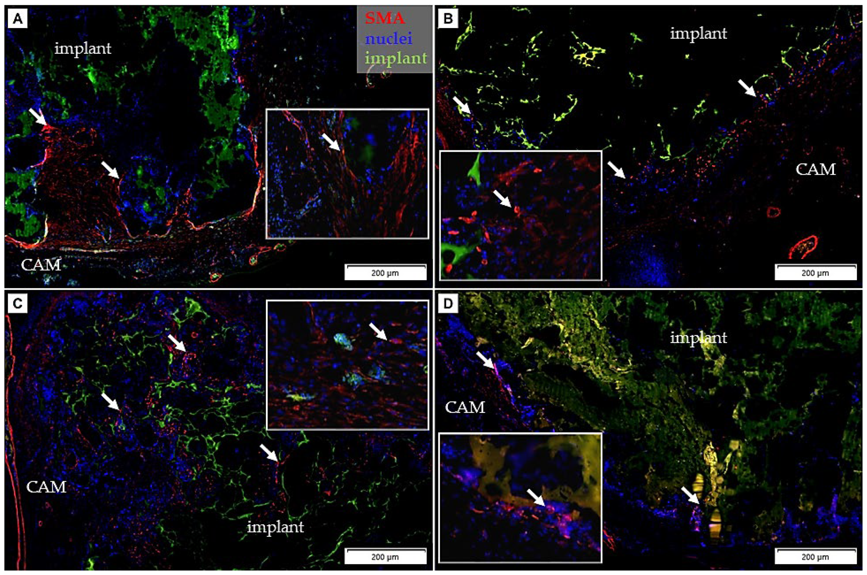 Cancers 14 04194 g008 Cancers 14 04194 g008