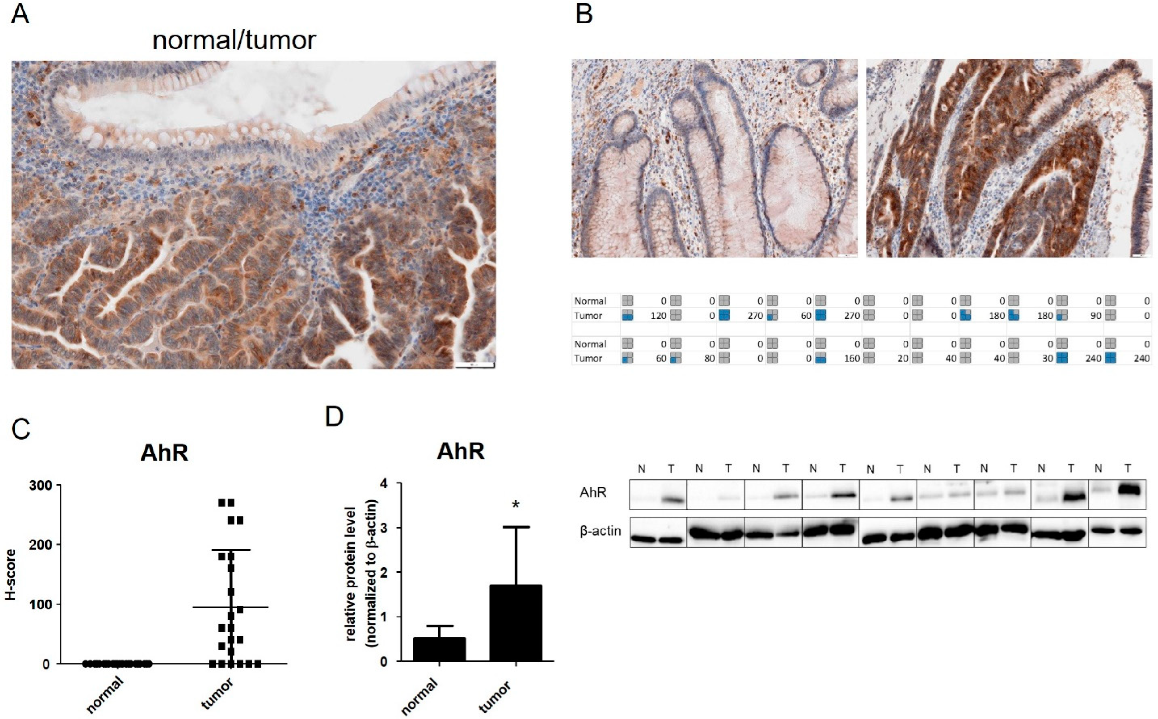 Inhibition of Aryl Hydrocarbon Receptor (AhR) Expression Disrupts 