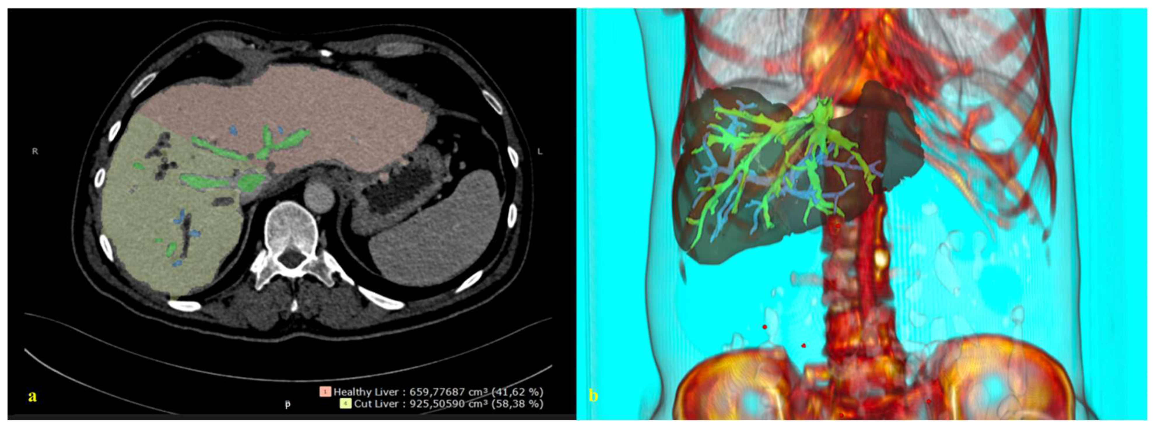 Cancers 14 04268 g002 550