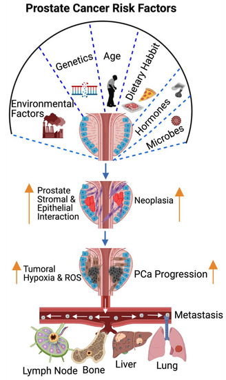 Bone Health Management in the Continuum of Prostate Cancer Disease