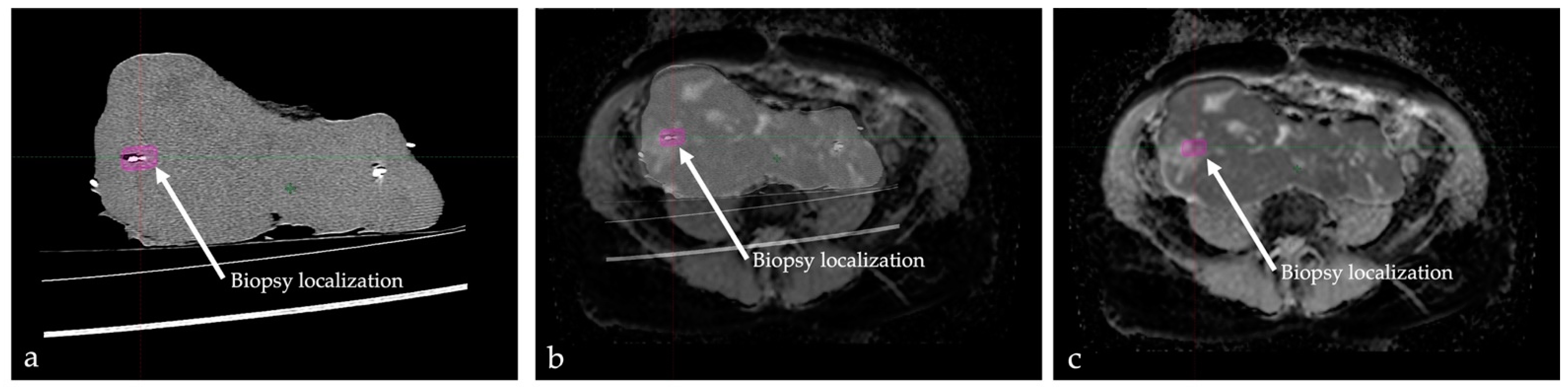 Cancers 14 04331 g002