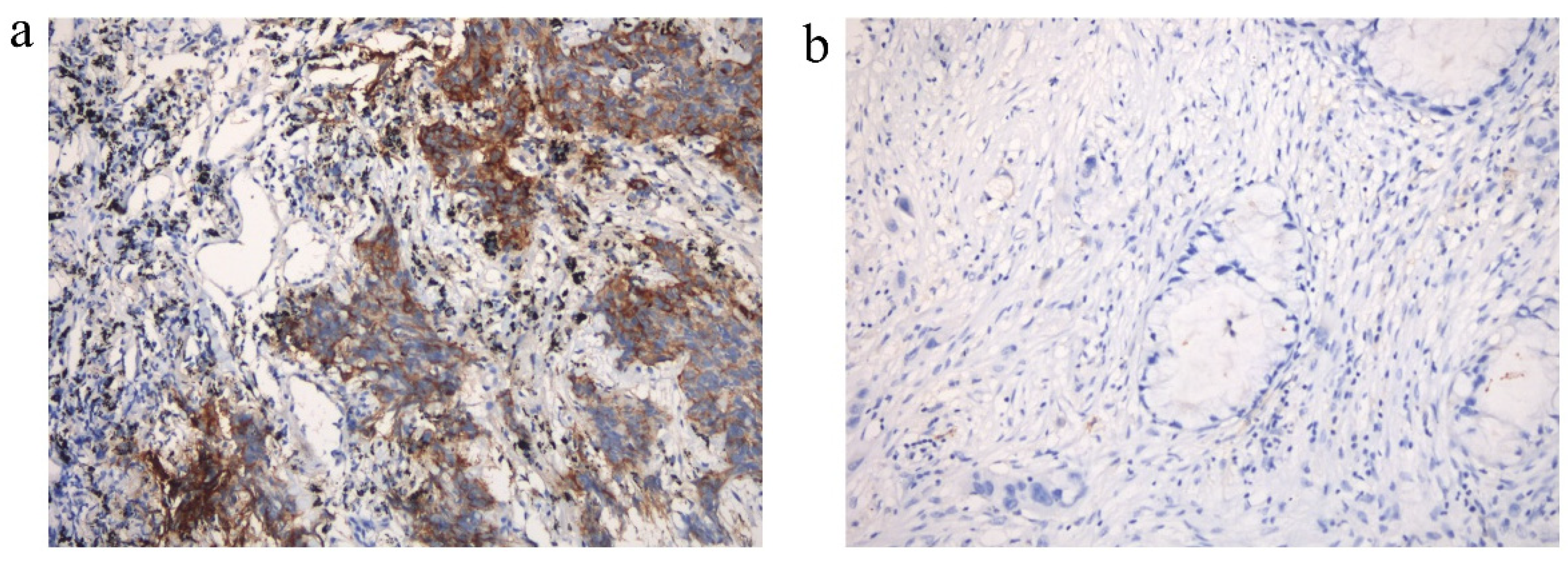 Cancers 14 04333 g0a2 550