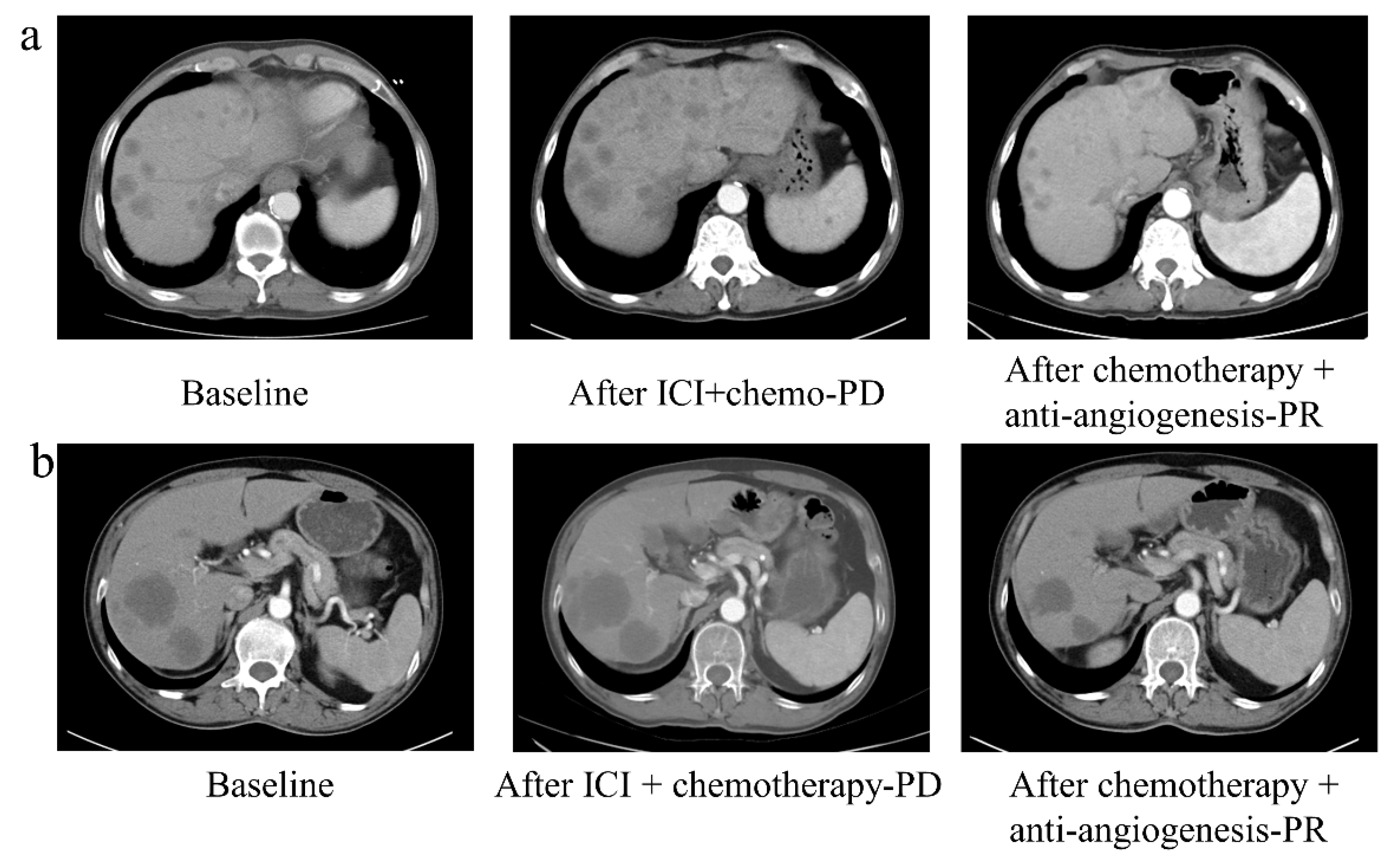 Cancers 14 04333 g0a3 550