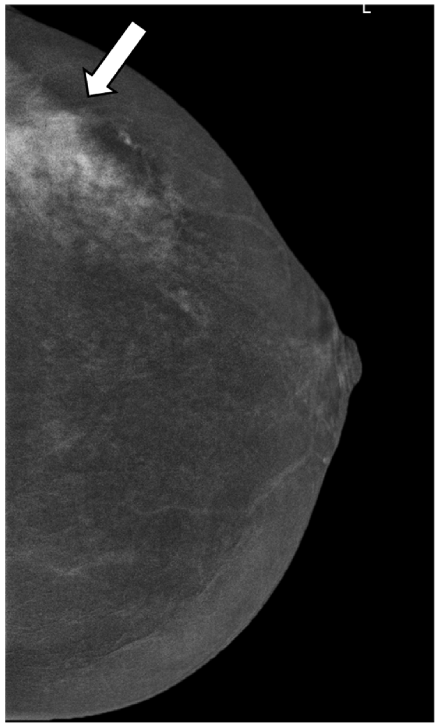 Cancers 14 04337 g003