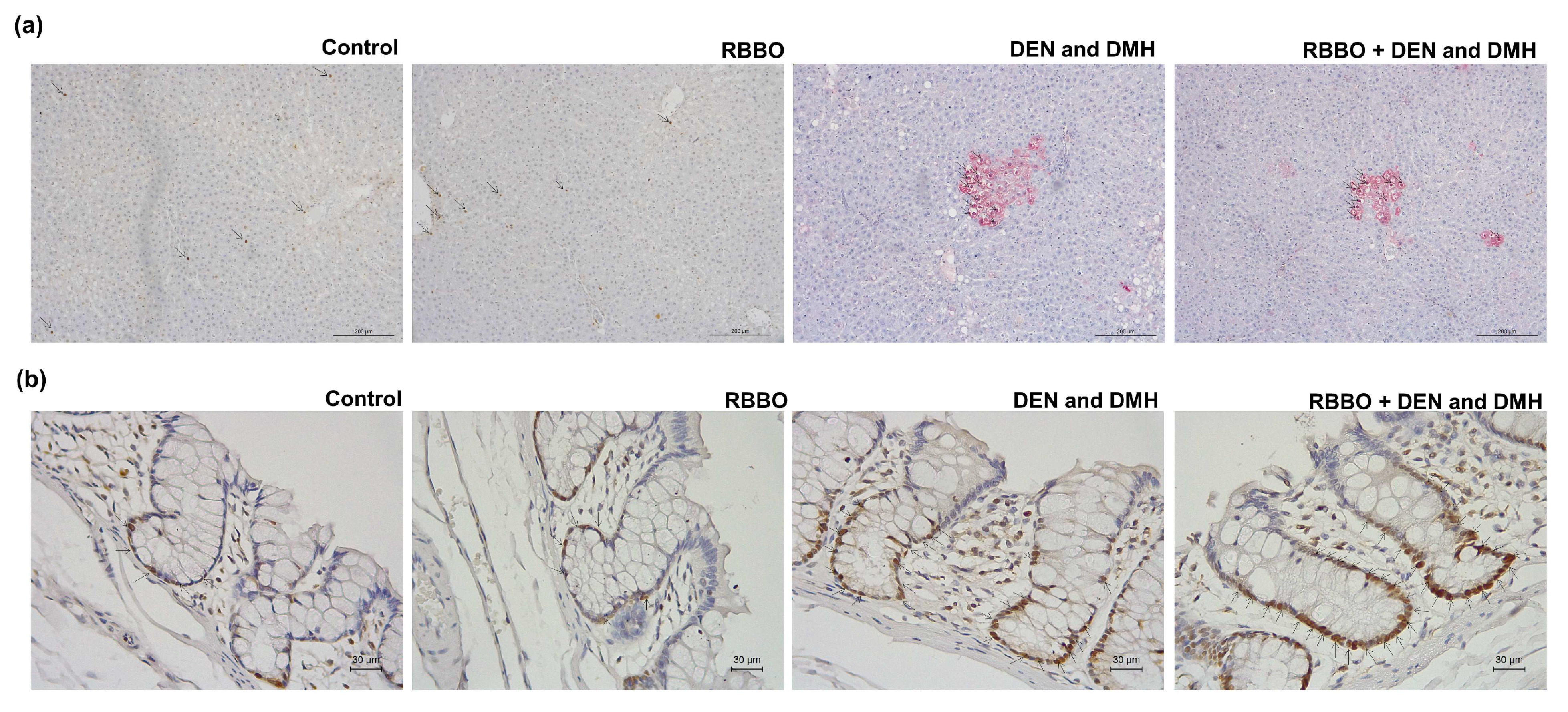 Cancers 14 04358 g003