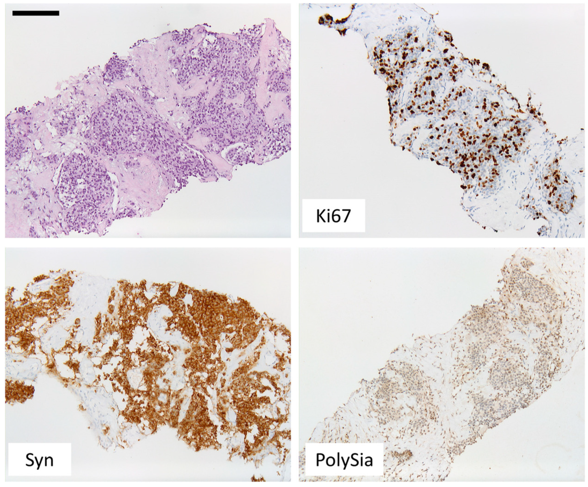 Cancers 14 04376 g003 Cancers 14 04376 g003