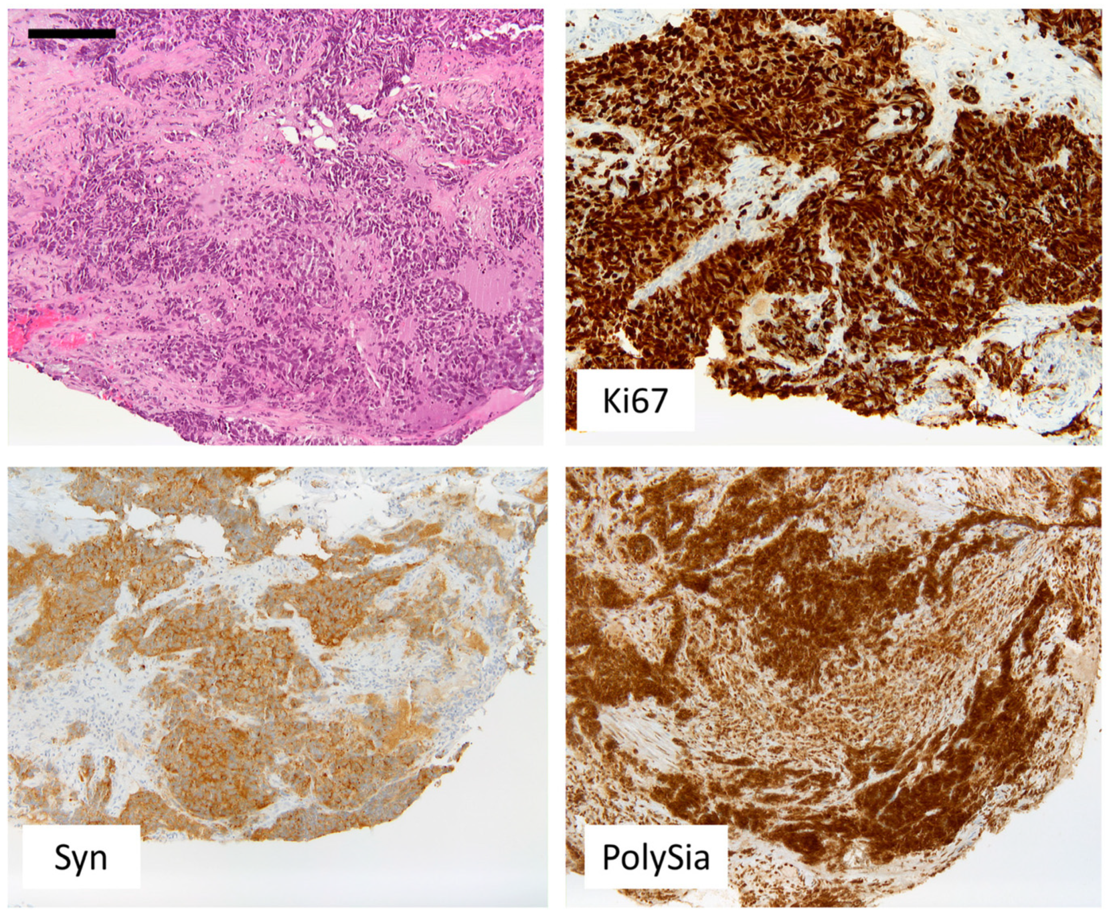 Cancers 14 04376 g004 Cancers 14 04376 g004