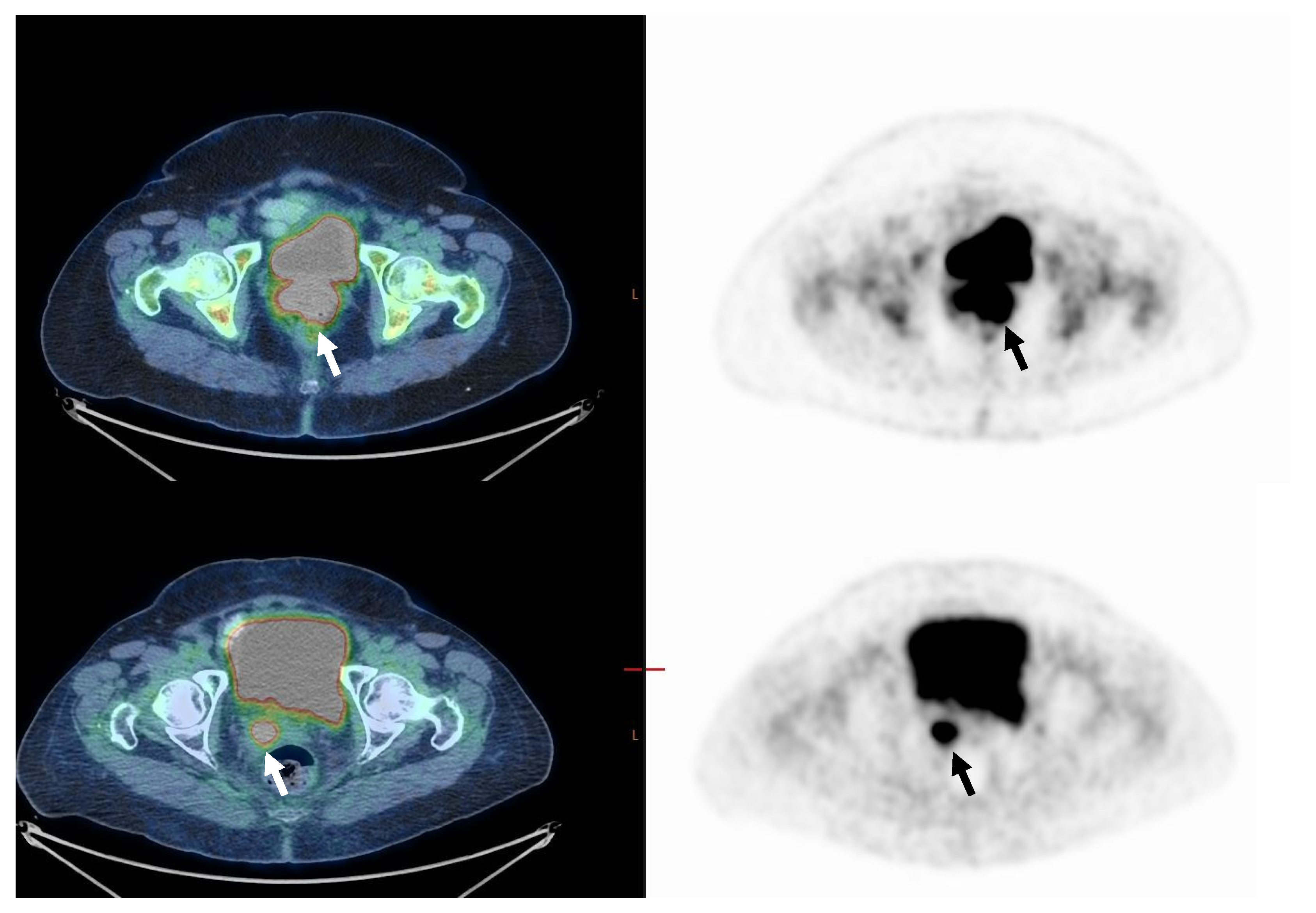 Cancers 14 04382 g002 550