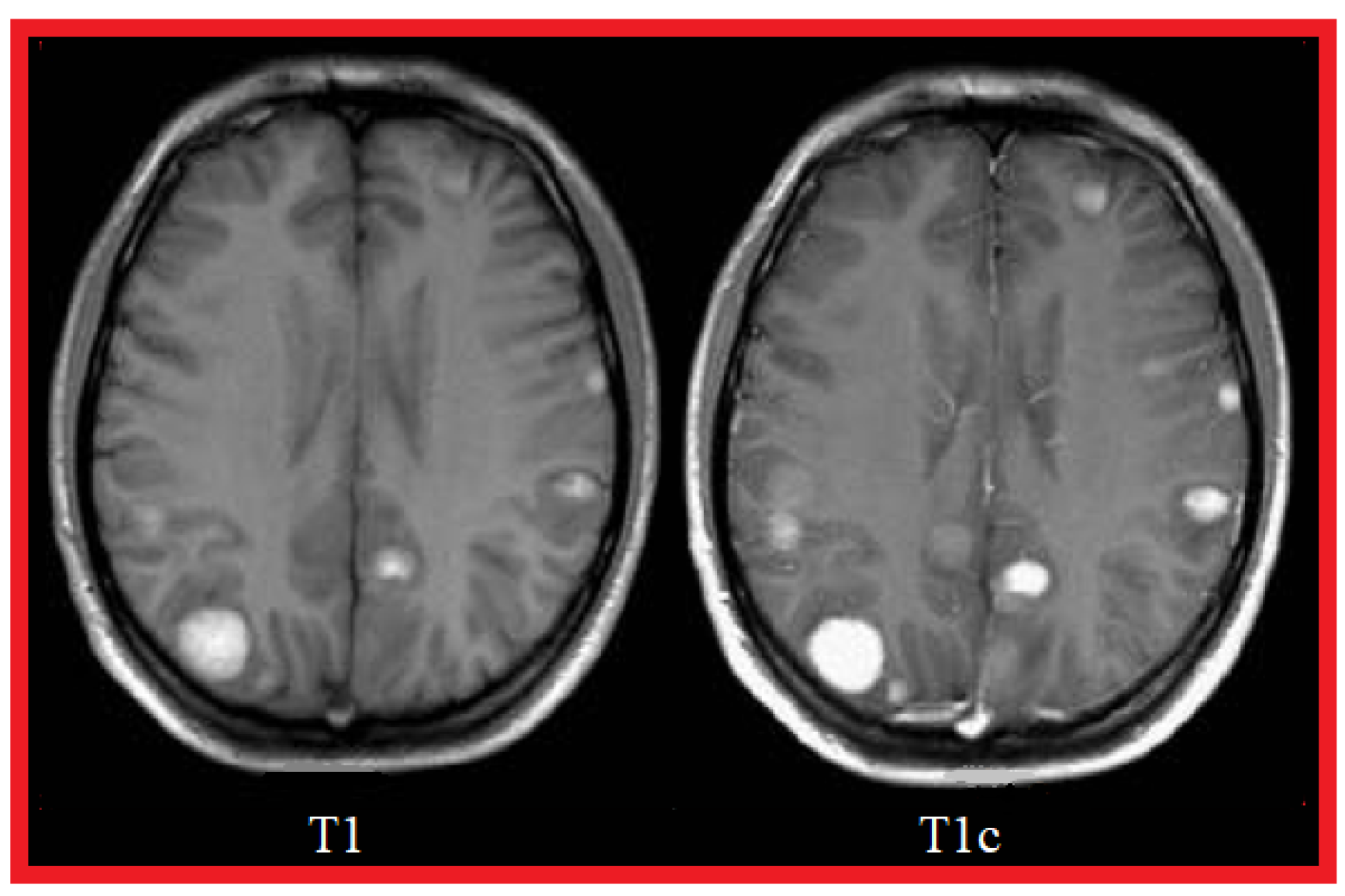 Cancers 14 04399 g003 Cancers 14 04399 g003