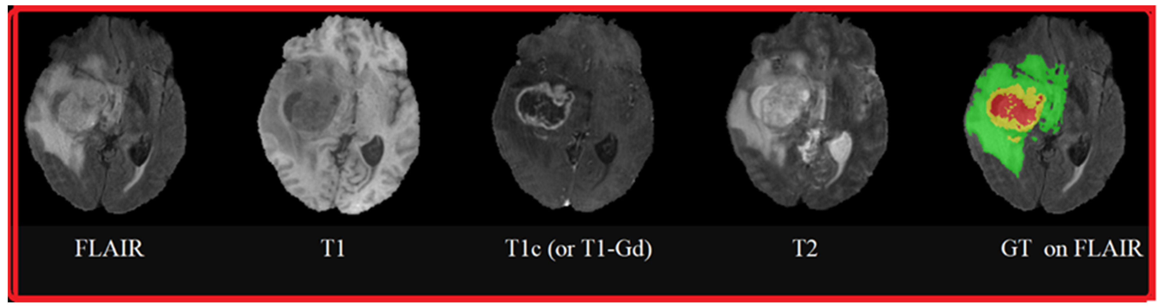 Cancers 14 04399 g004 Cancers 14 04399 g004