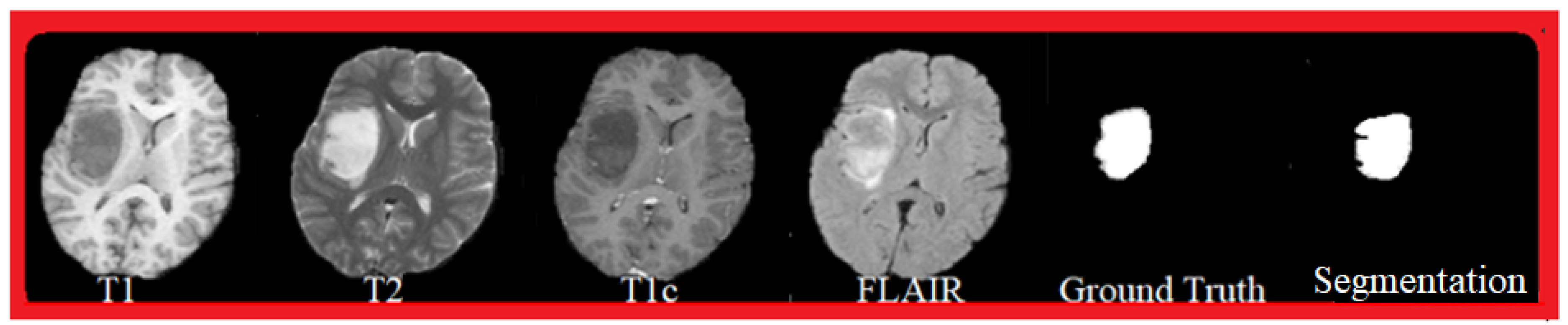 Cancers 14 04399 g005 Cancers 14 04399 g005