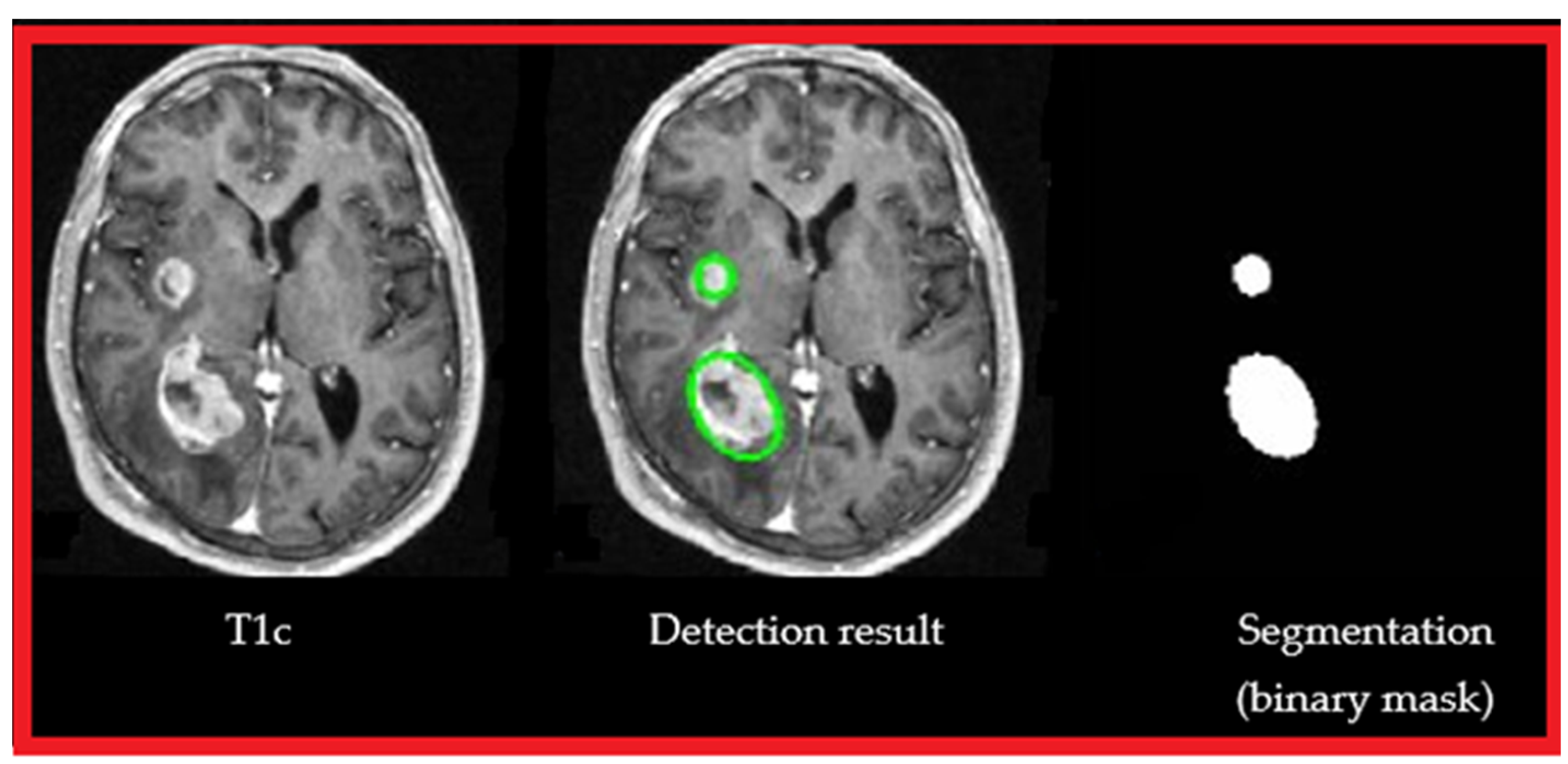 Cancers 14 04399 g006 Cancers 14 04399 g006