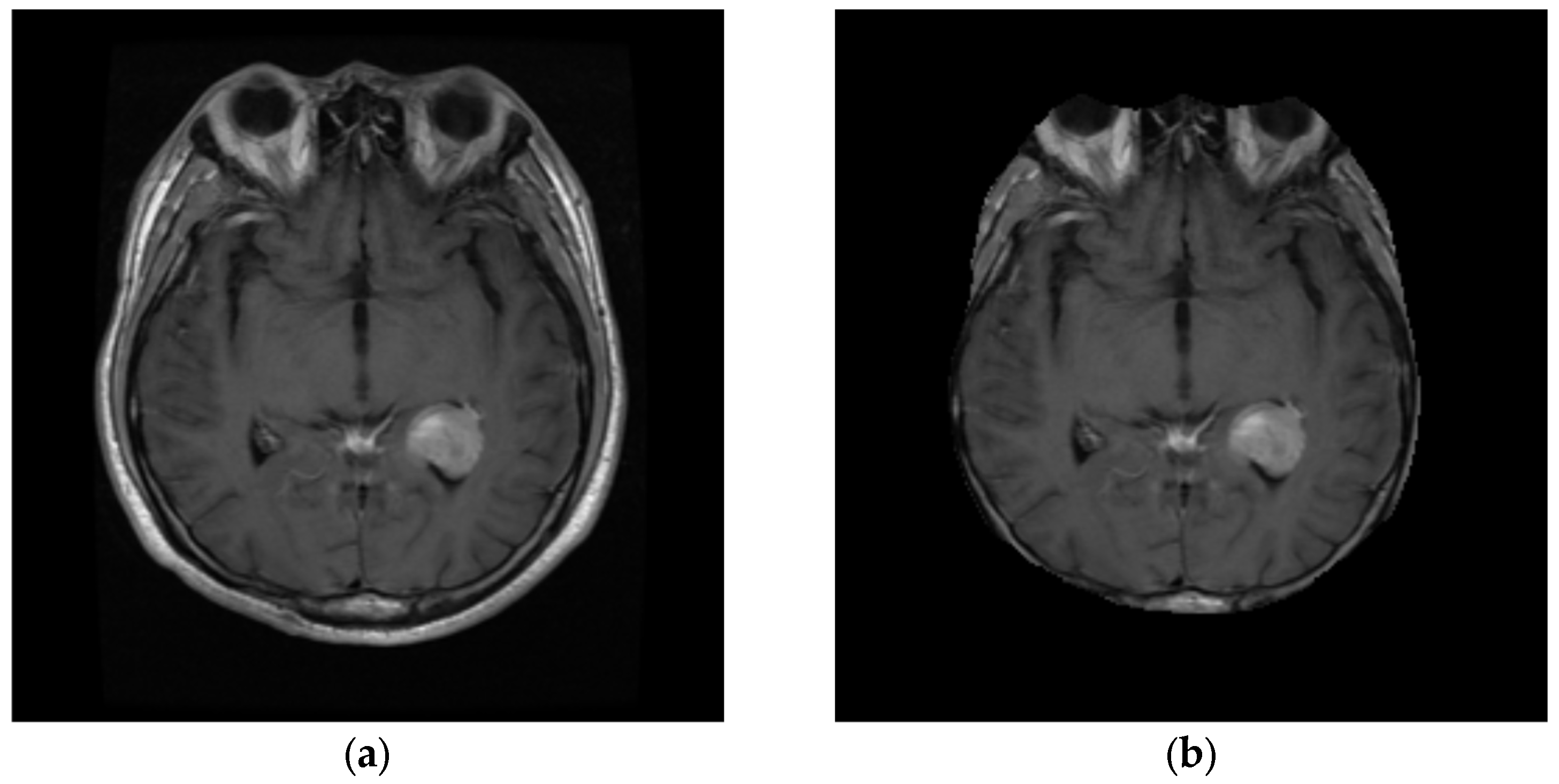 Cancers 14 04399 g009 Cancers 14 04399 g009