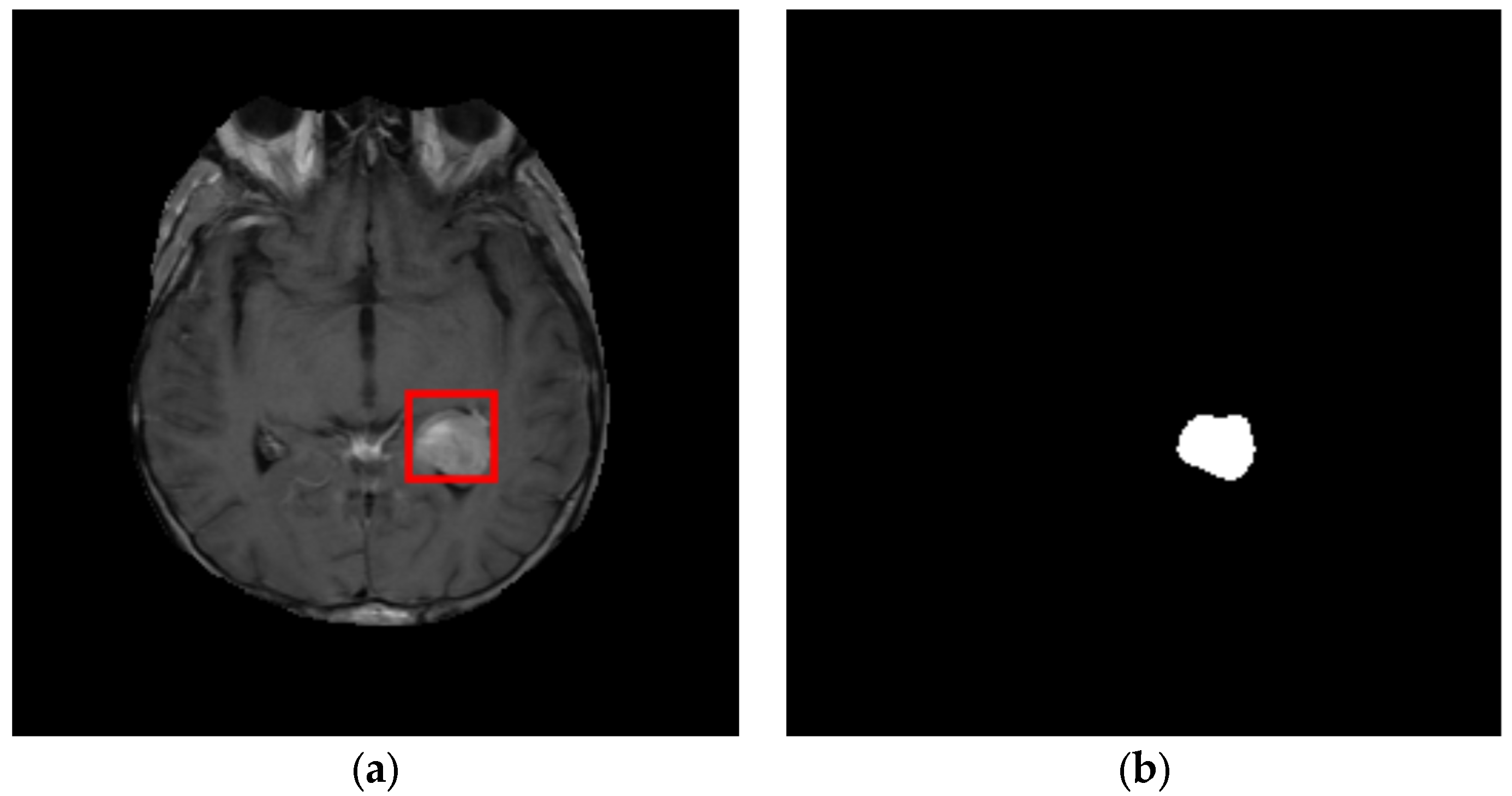 Cancers 14 04399 g011 Cancers 14 04399 g011