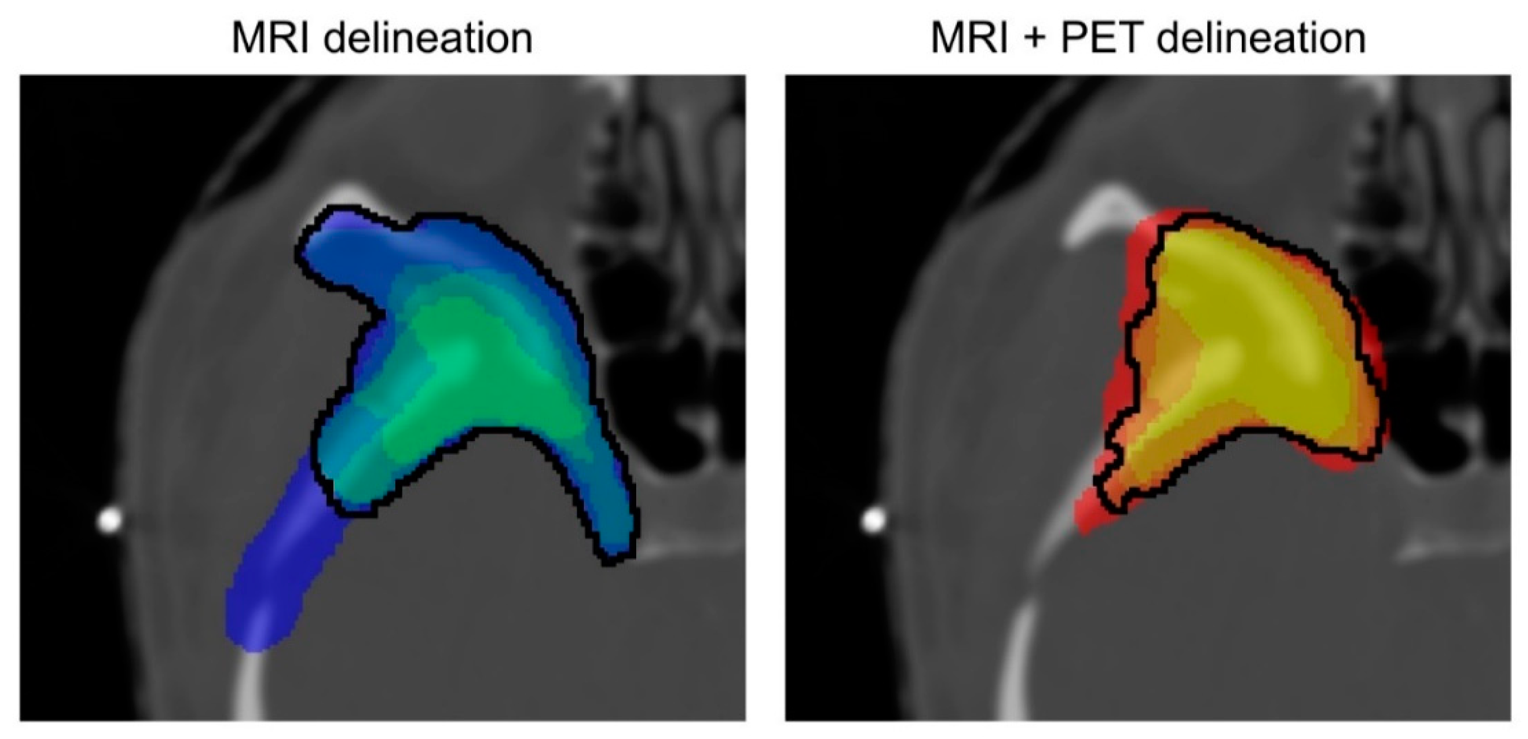 Cancers 14 04435 g001