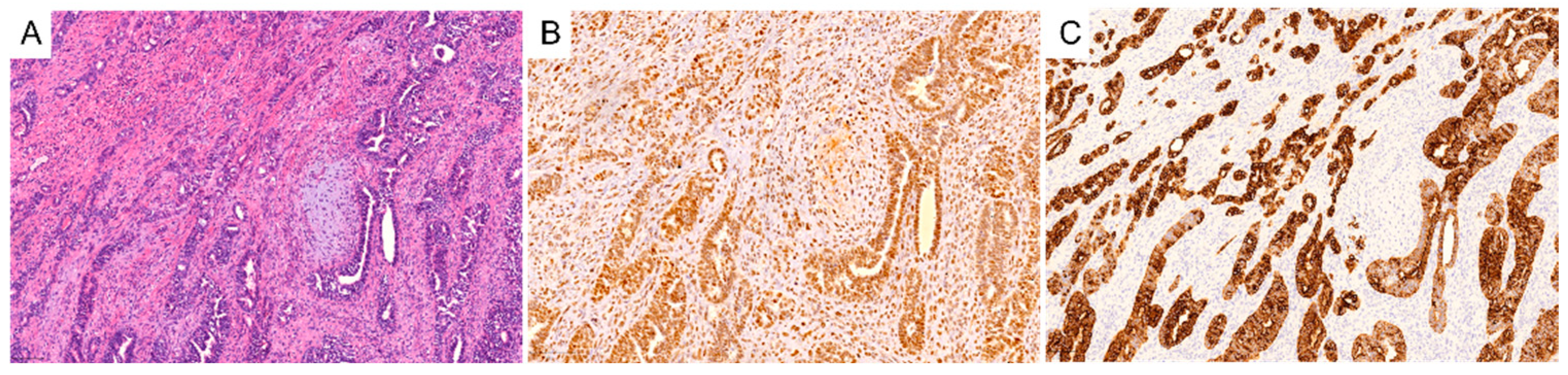 Cancers 14 04465 g001