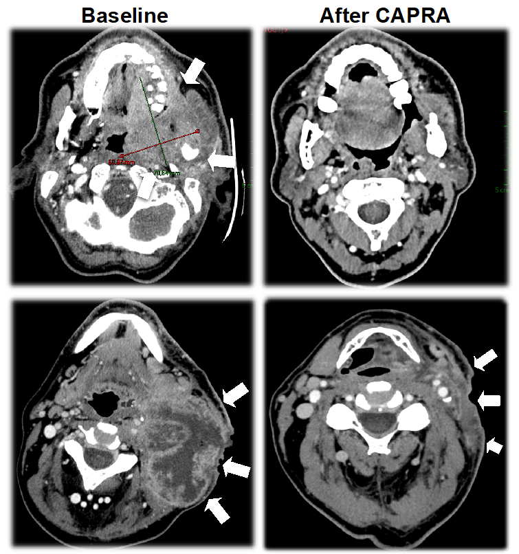 Cancers 14 04509 g003