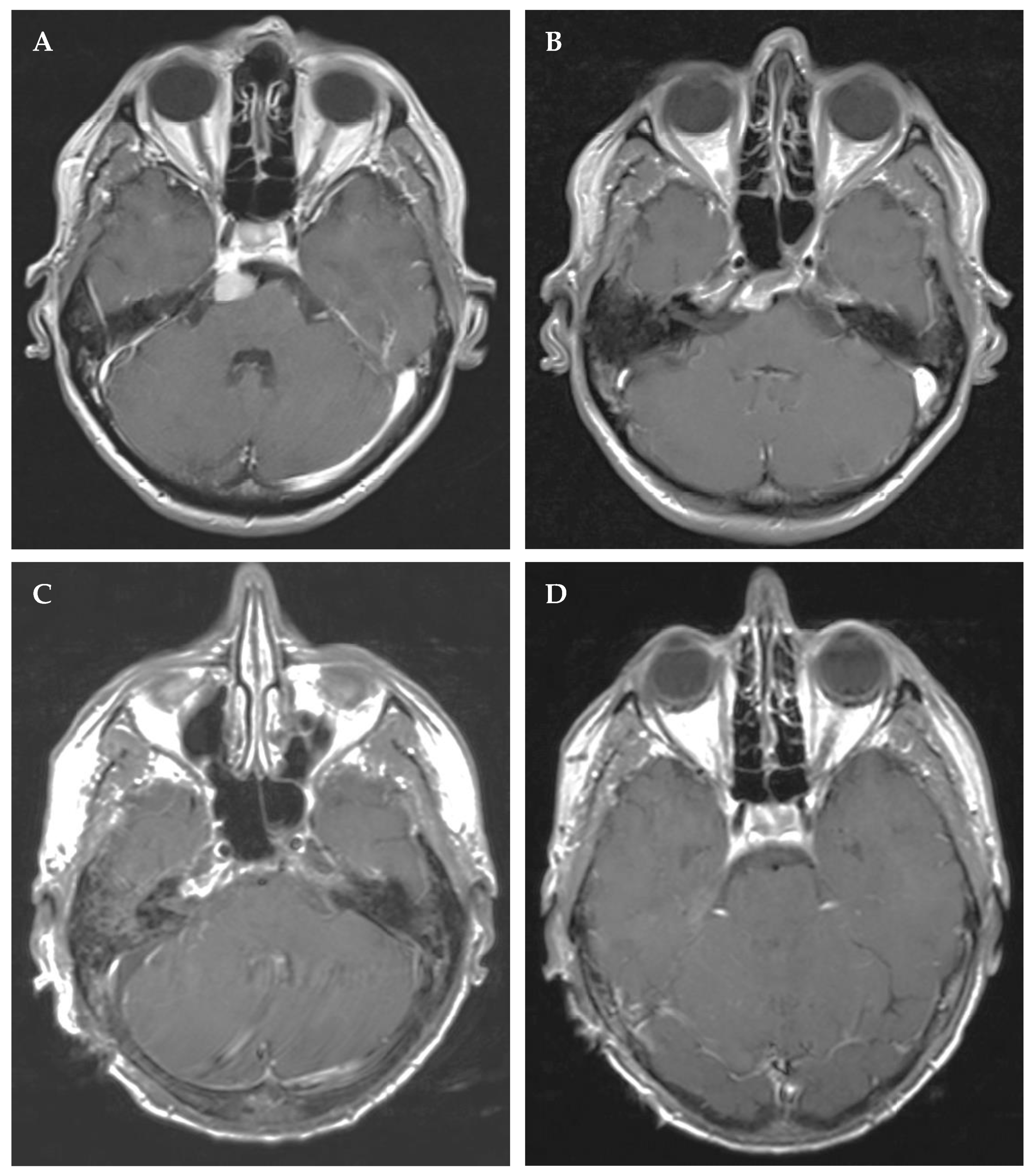 Cancers 14 04517 g001 Cancers 14 04517 g001