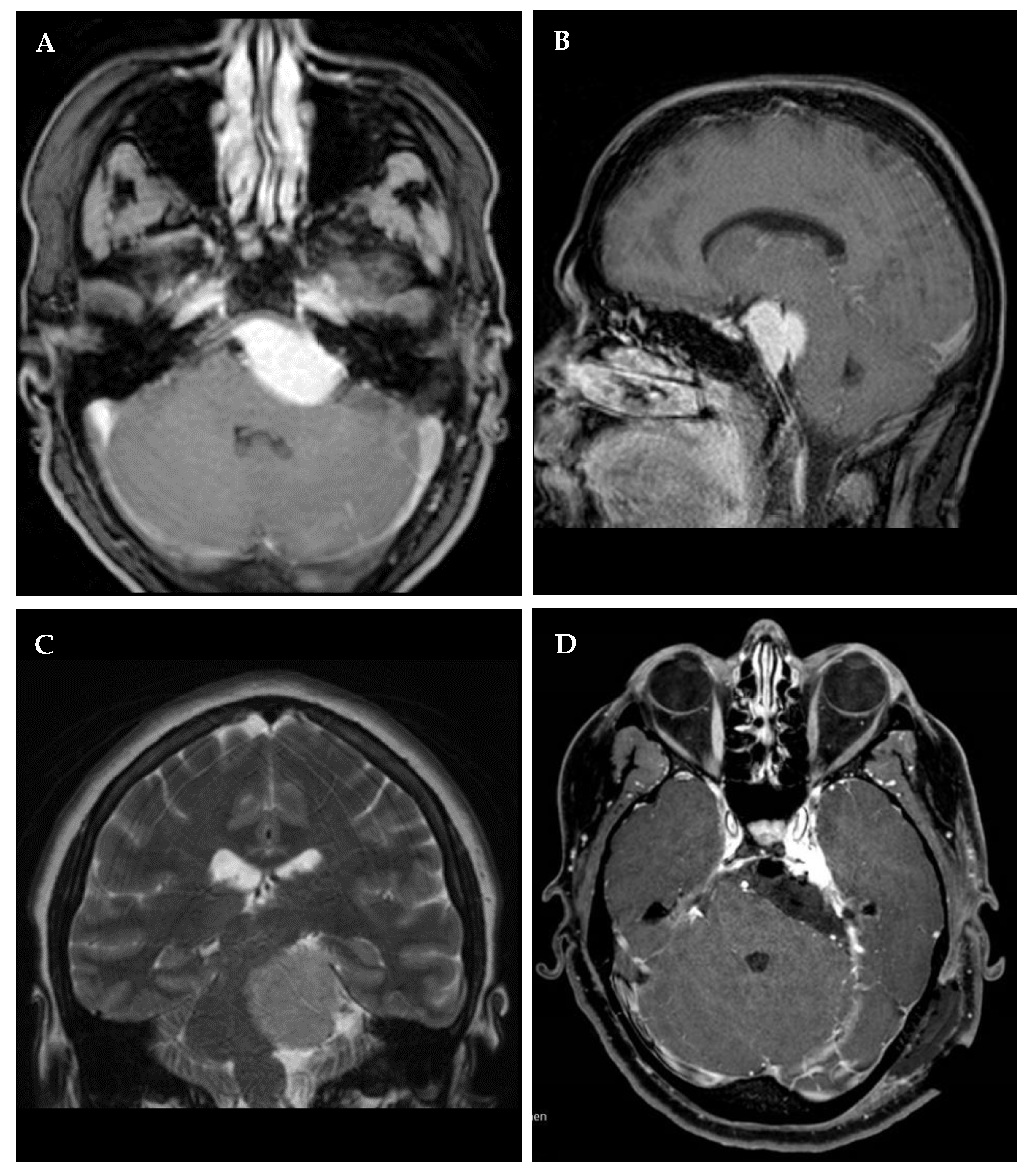 Cancers 14 04517 g004 Cancers 14 04517 g004