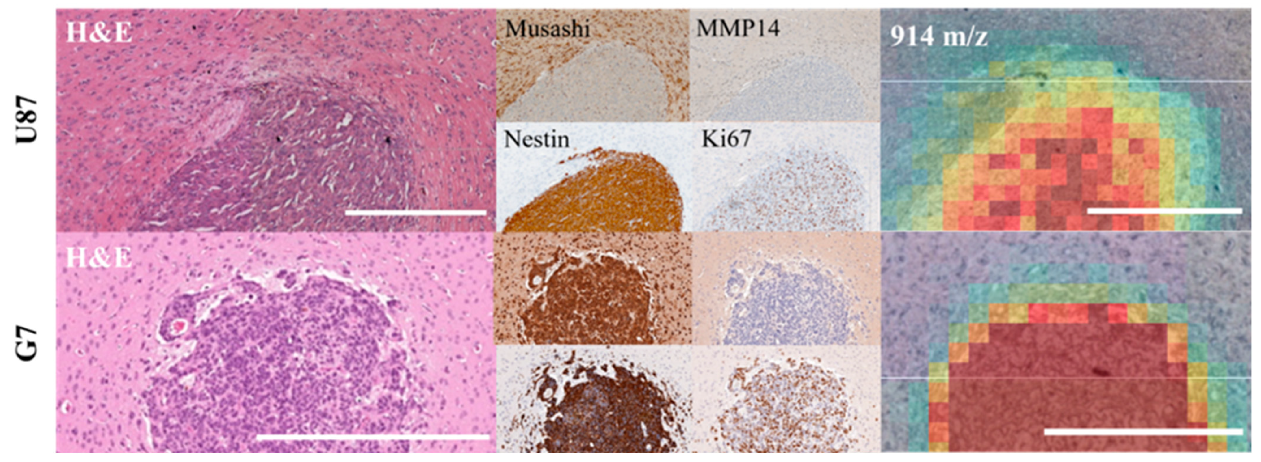 Cancers 14 04559 g005