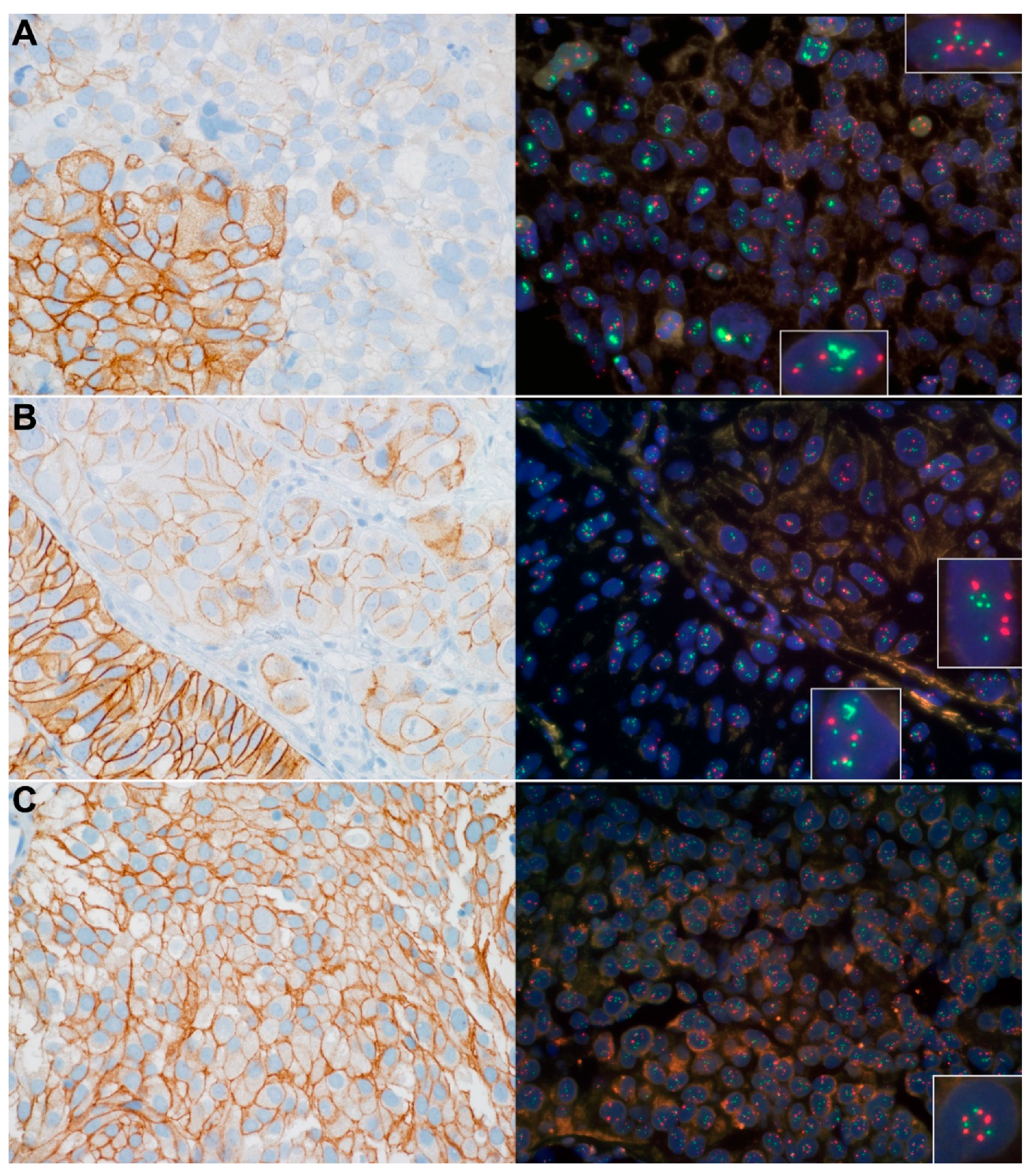 Cancers 14 04570 g001 Cancers 14 04570 g001