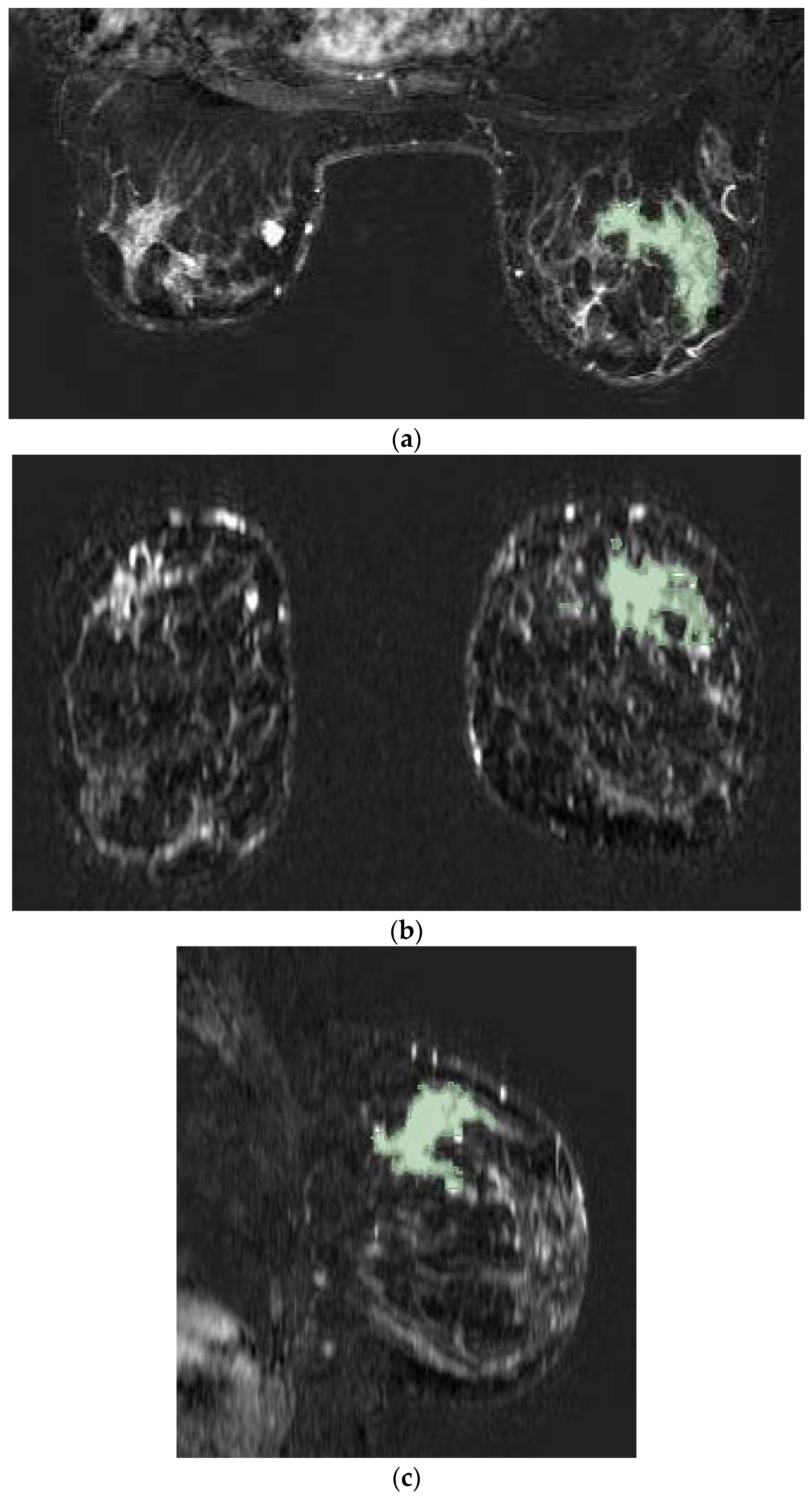 Cancers 14 04574 g001 550