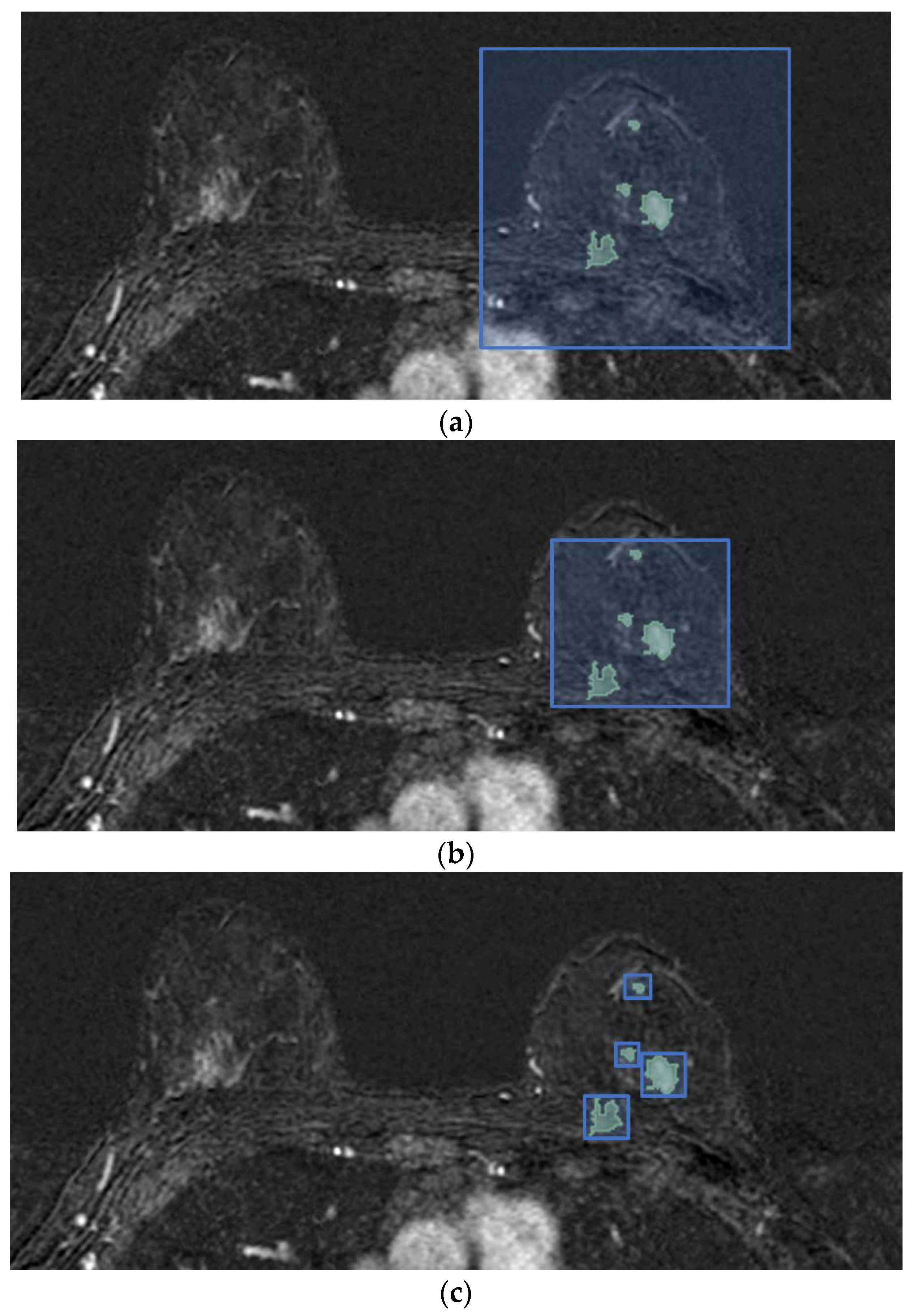 Cancers 14 04574 g002 550