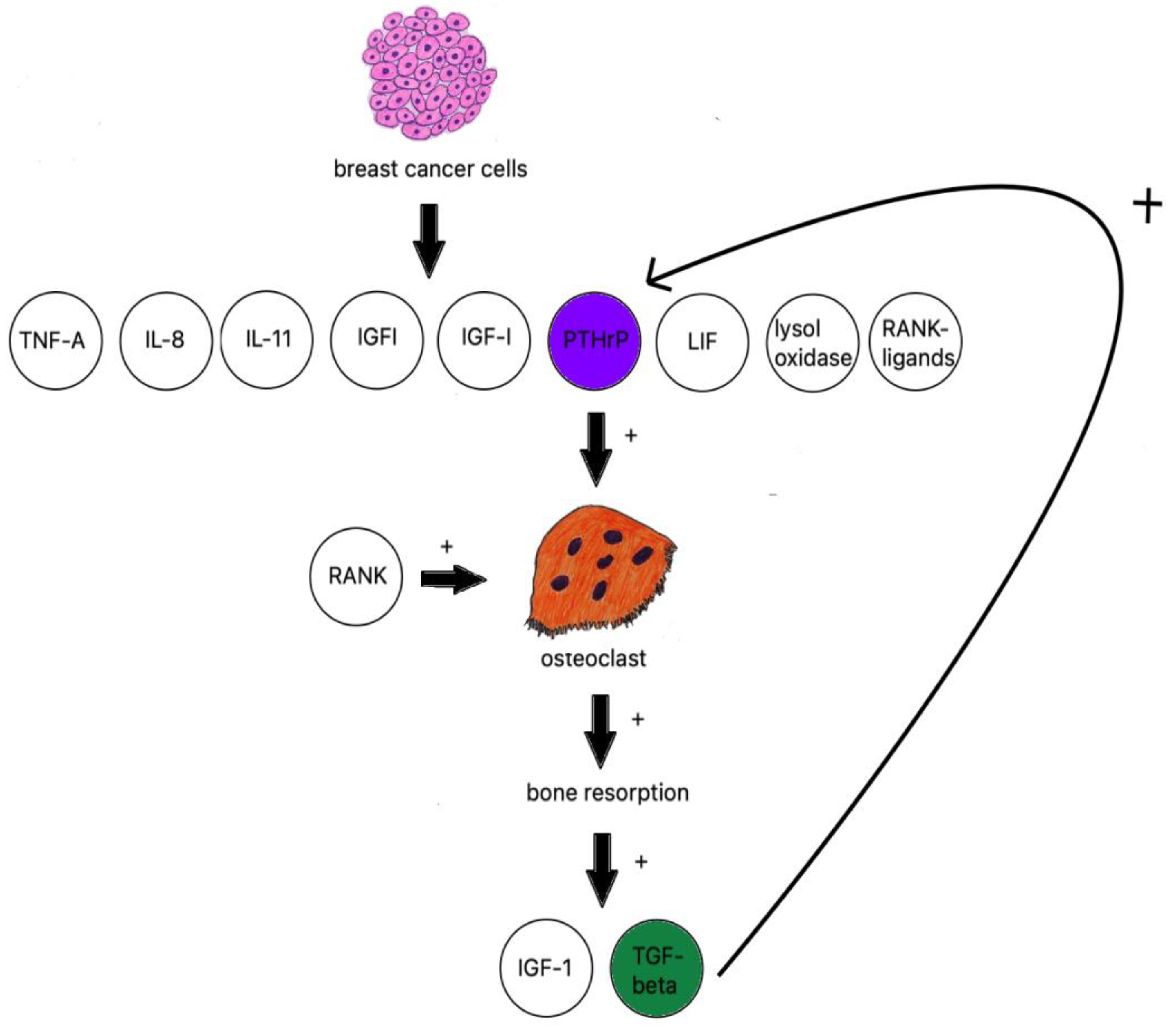 健康・医学 Thoracic Tumours Tumor-derived exosomal CCT6A serves as a matchmaker