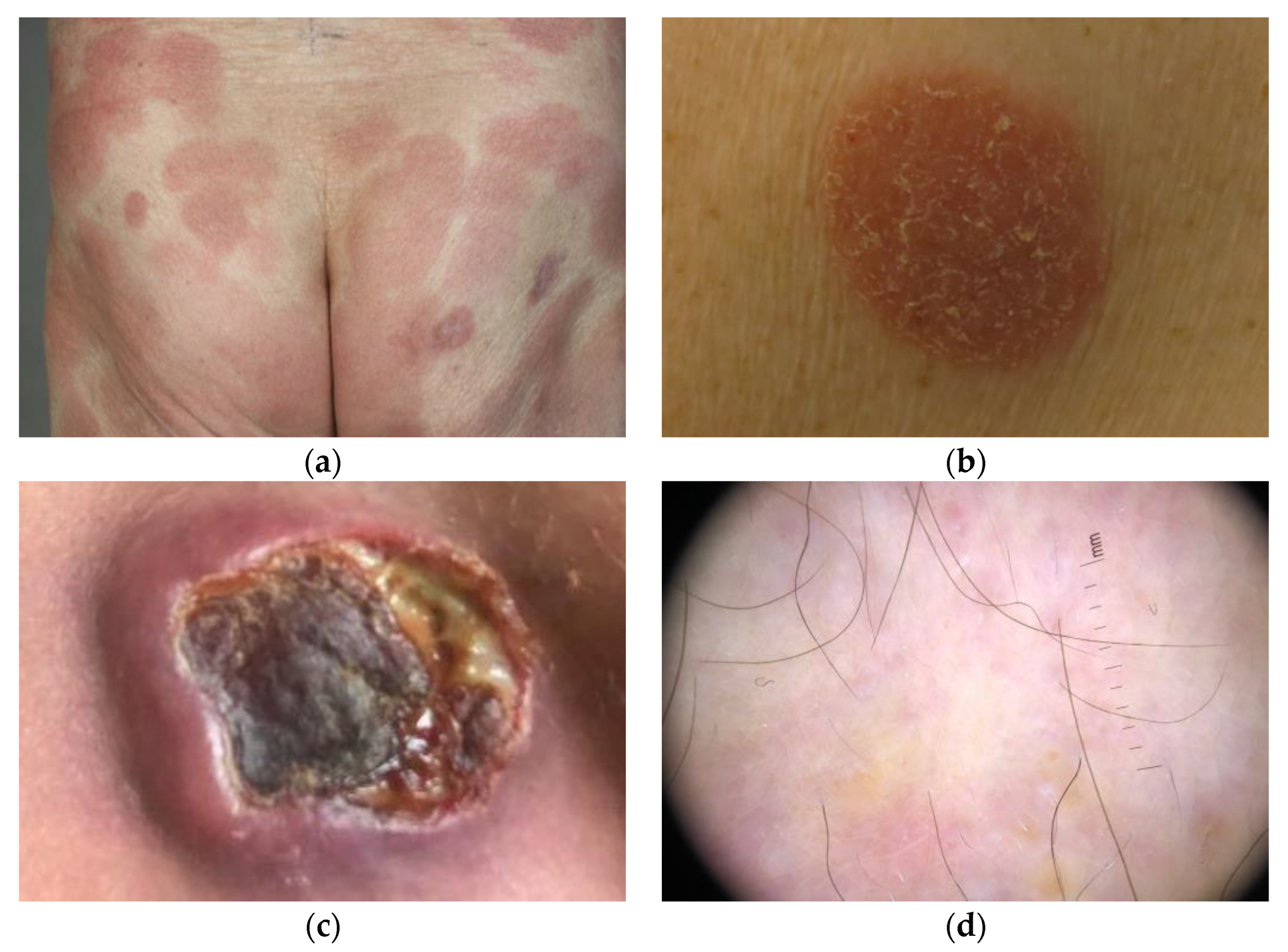 Cancers 14 04661 g001