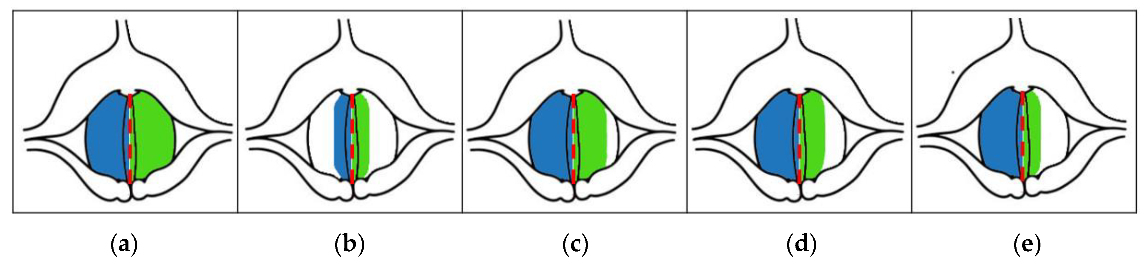 Cancers 14 04697 g005