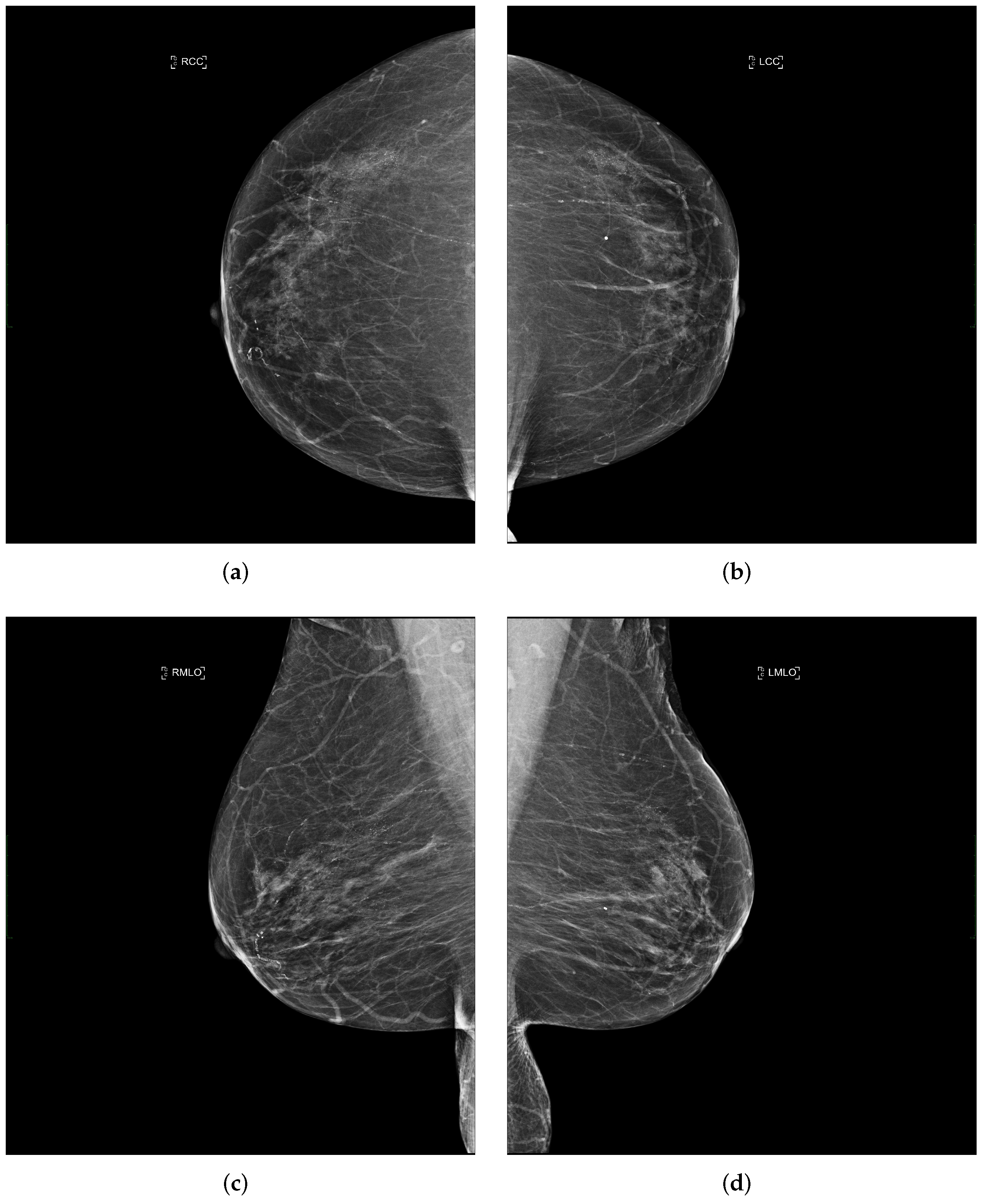 Cancers 14 04704 g003 Cancers 14 04704 g003