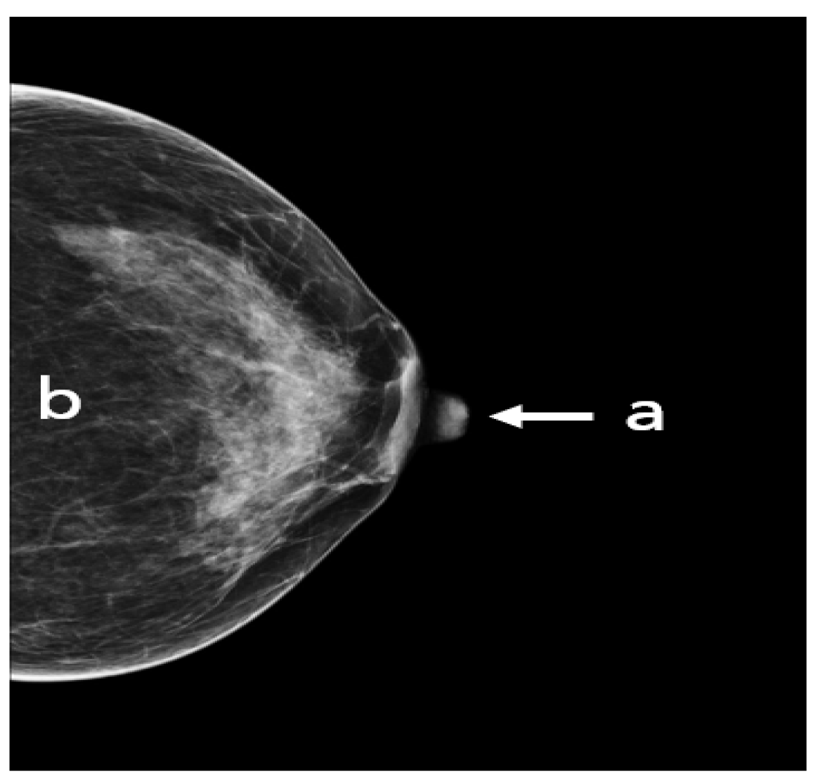 Cancers 14 04704 g007 Cancers 14 04704 g007