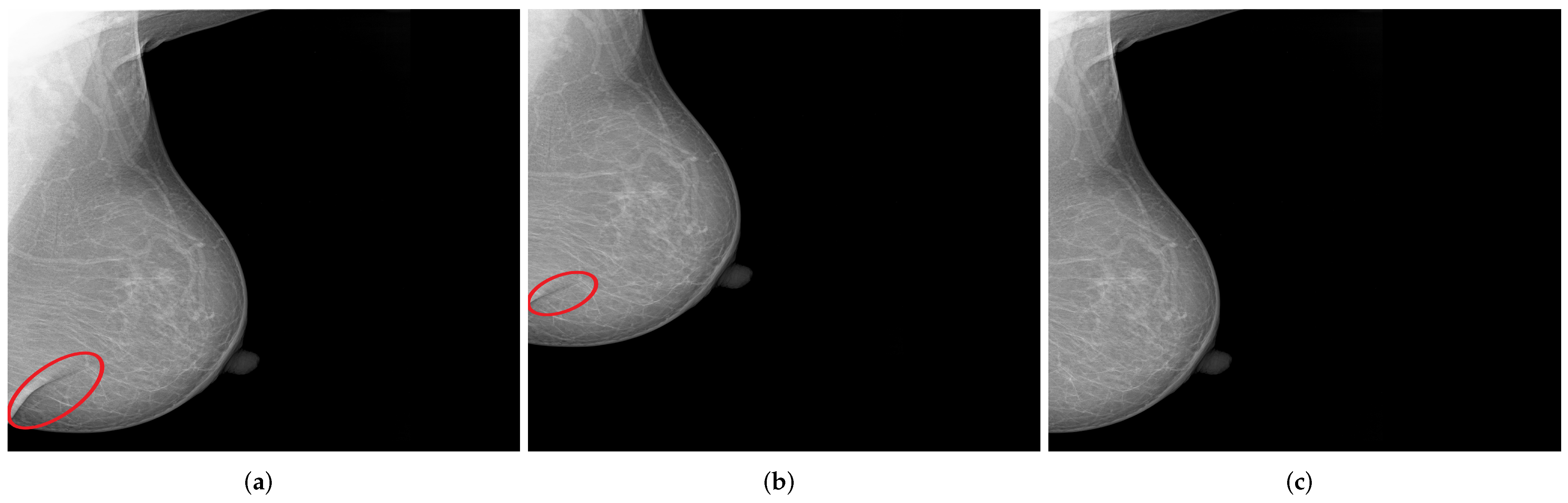 Cancers 14 04704 g013 Cancers 14 04704 g013