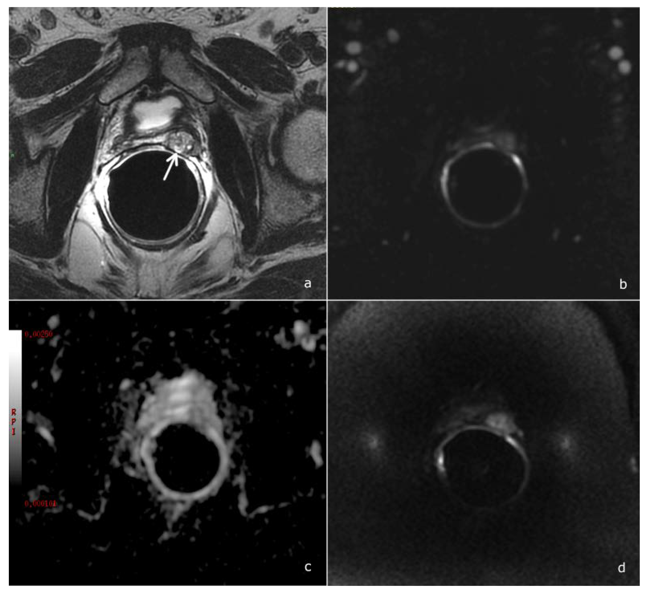 Cancers 14 04725 g003