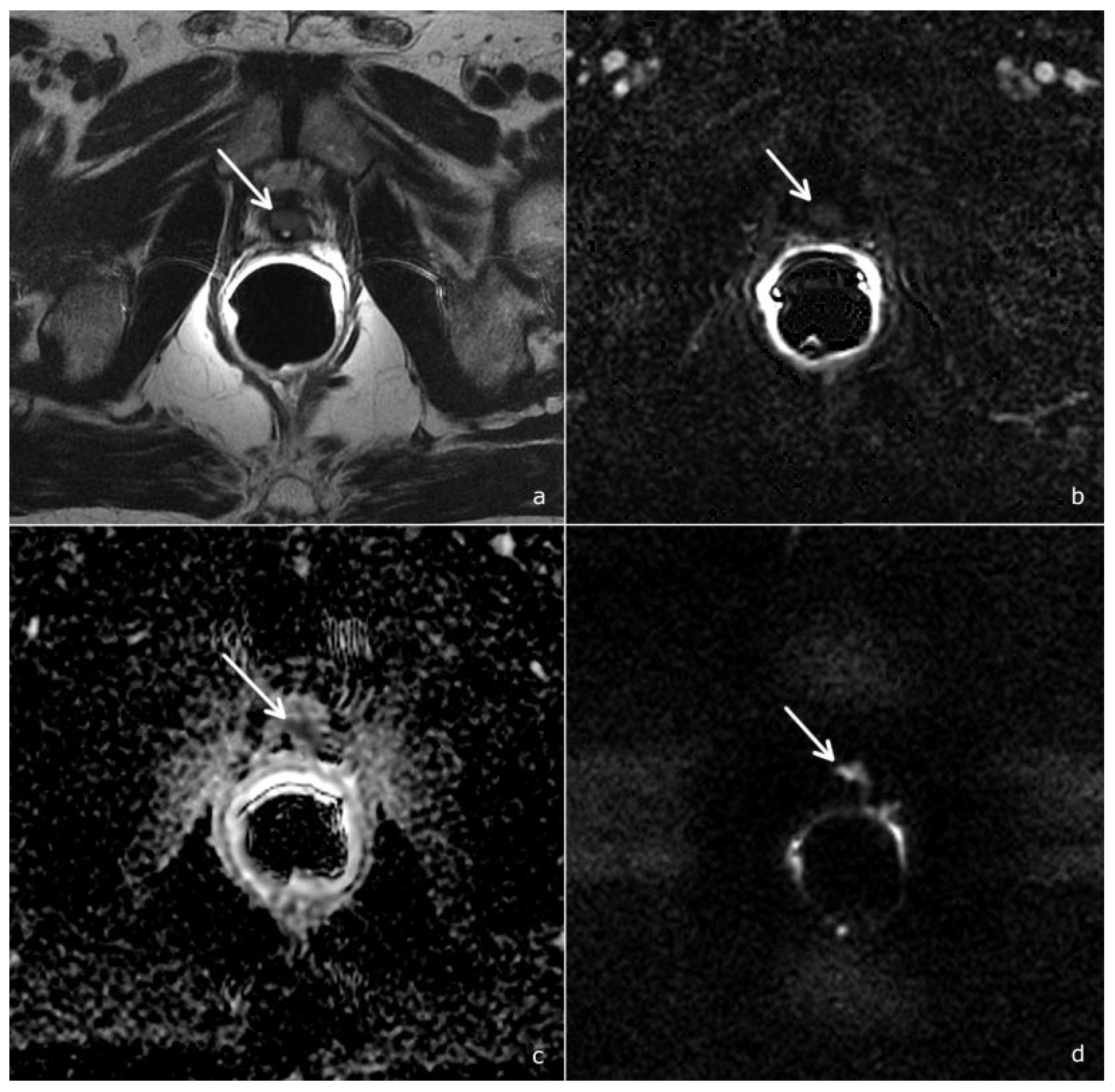 Cancers 14 04725 g004