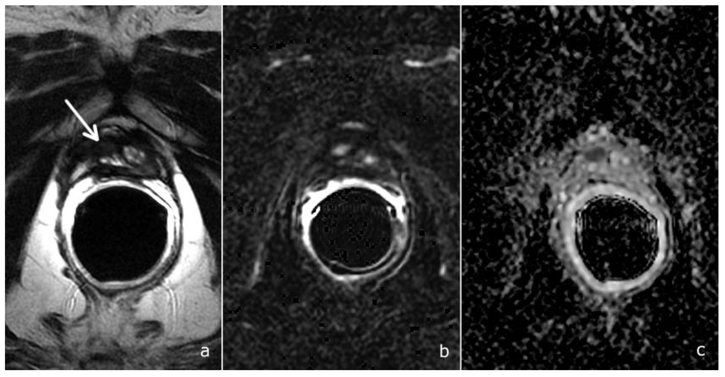 Cancers 14 04725 g005