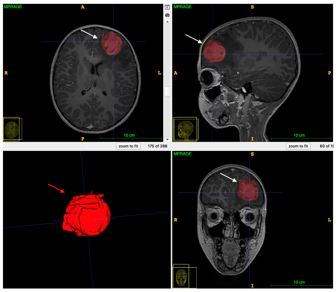 Cancers 14 04778 g001 Cancers 14 04778 g001