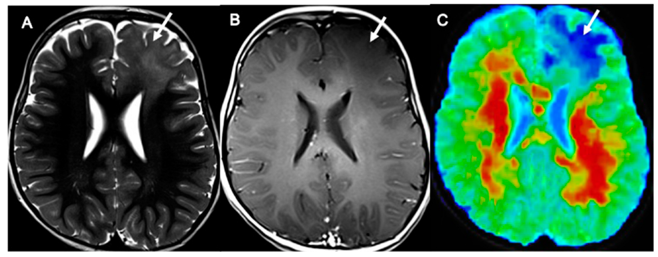 Cancers 14 04778 g007 Cancers 14 04778 g007