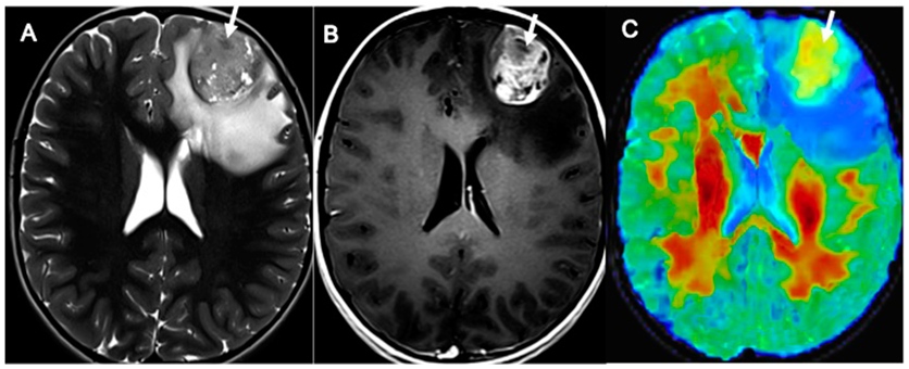 Cancers 14 04778 g008 Cancers 14 04778 g008