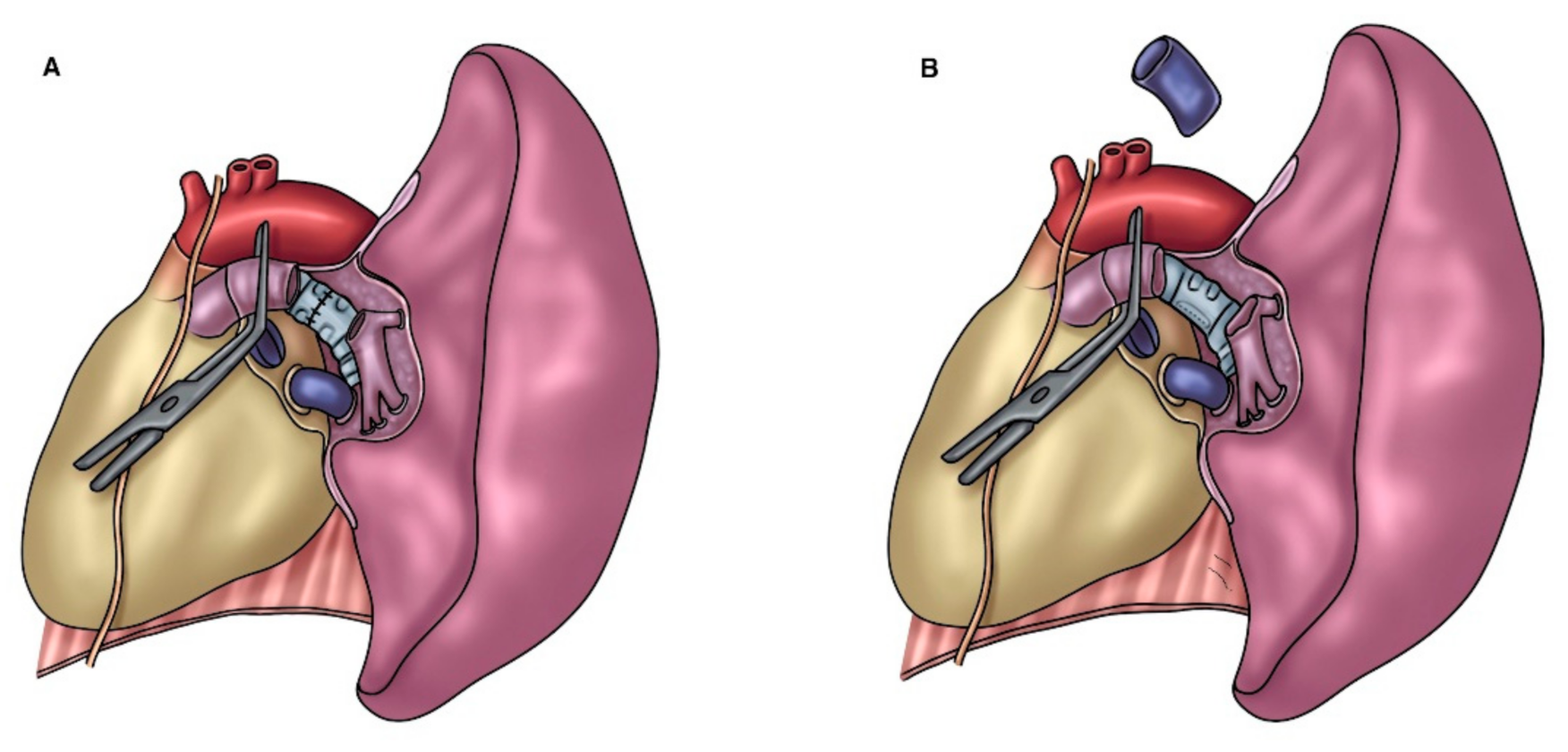 Cancers 14 04782 g005