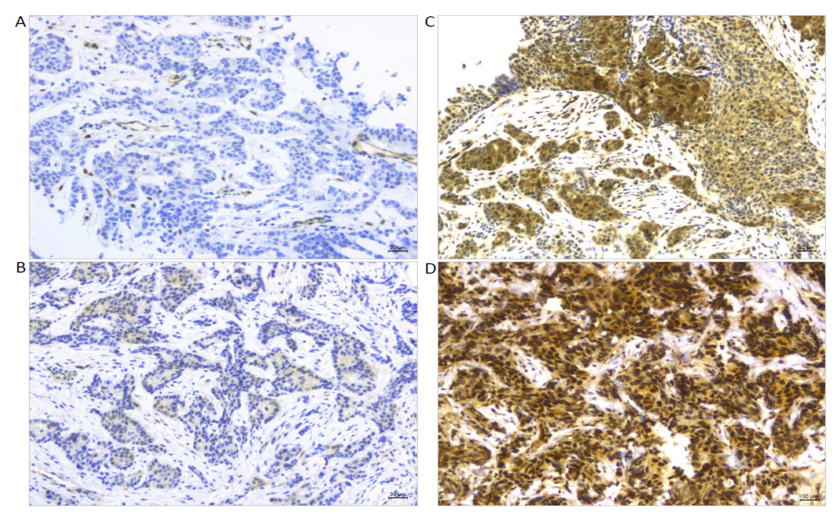 Cancers 14 04835 g005 Cancers 14 04835 g005