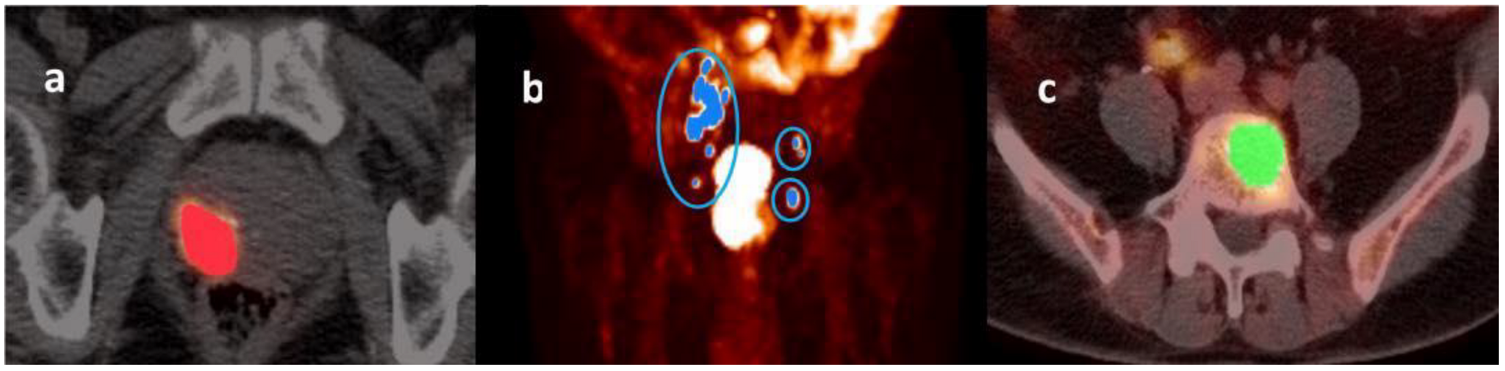 Cancers 14 04838 g001 Cancers 14 04838 g001