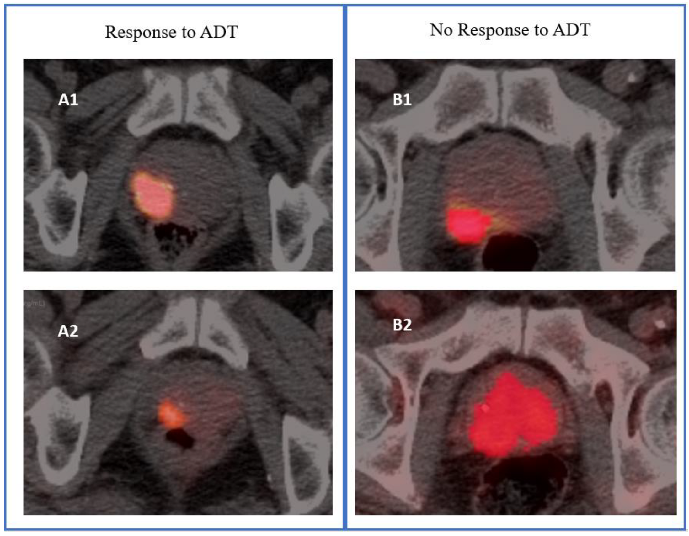 Cancers 14 04838 g002 Cancers 14 04838 g002