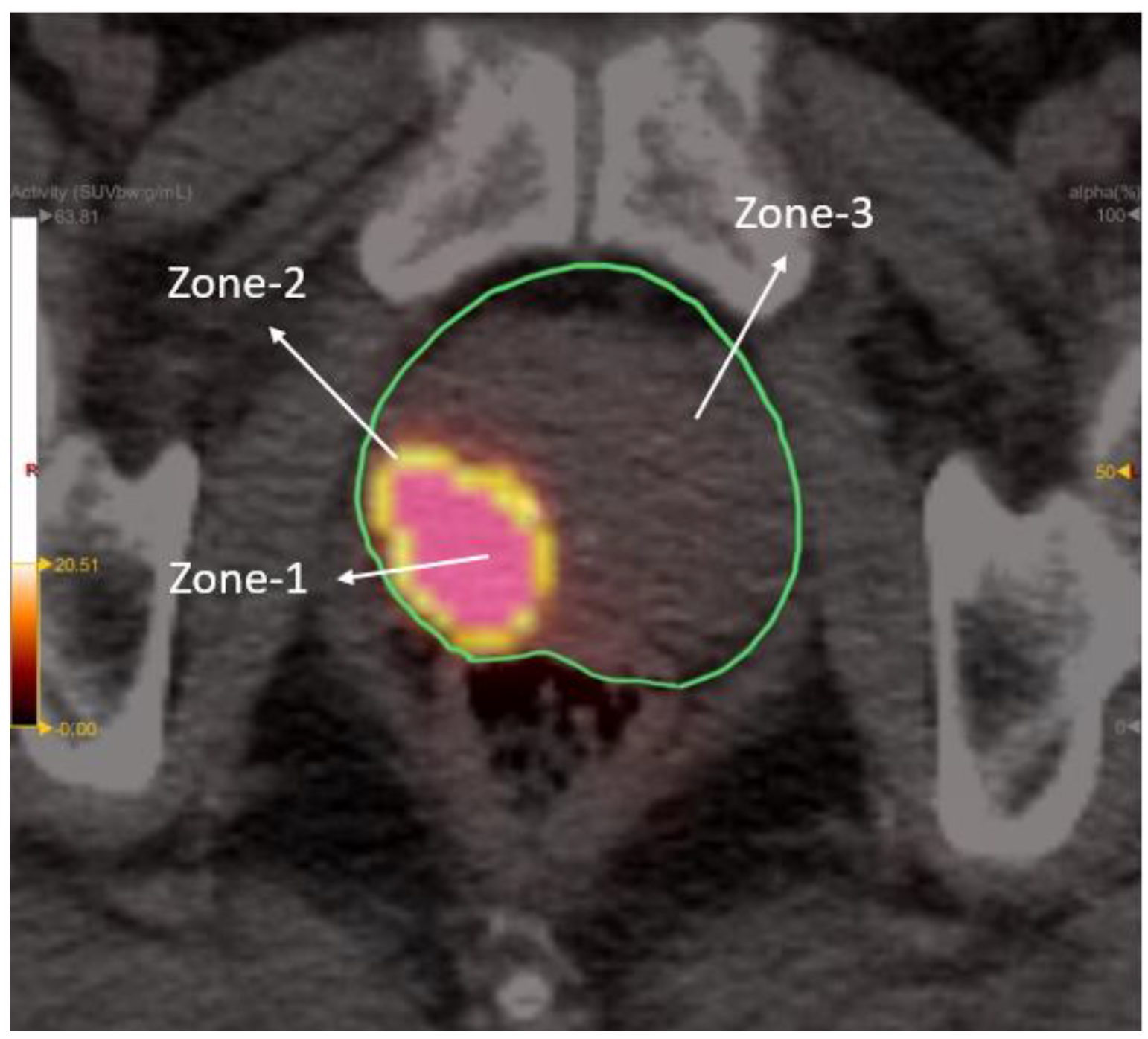 Cancers 14 04838 g003 Cancers 14 04838 g003