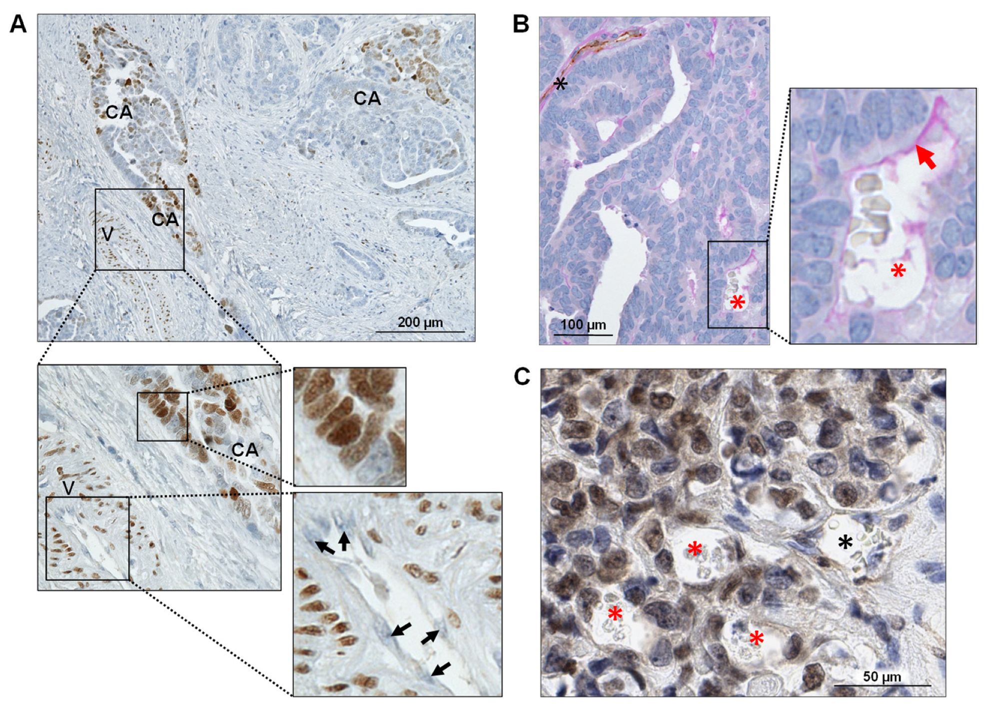 Cancers 14 04851 g005 Cancers 14 04851 g005