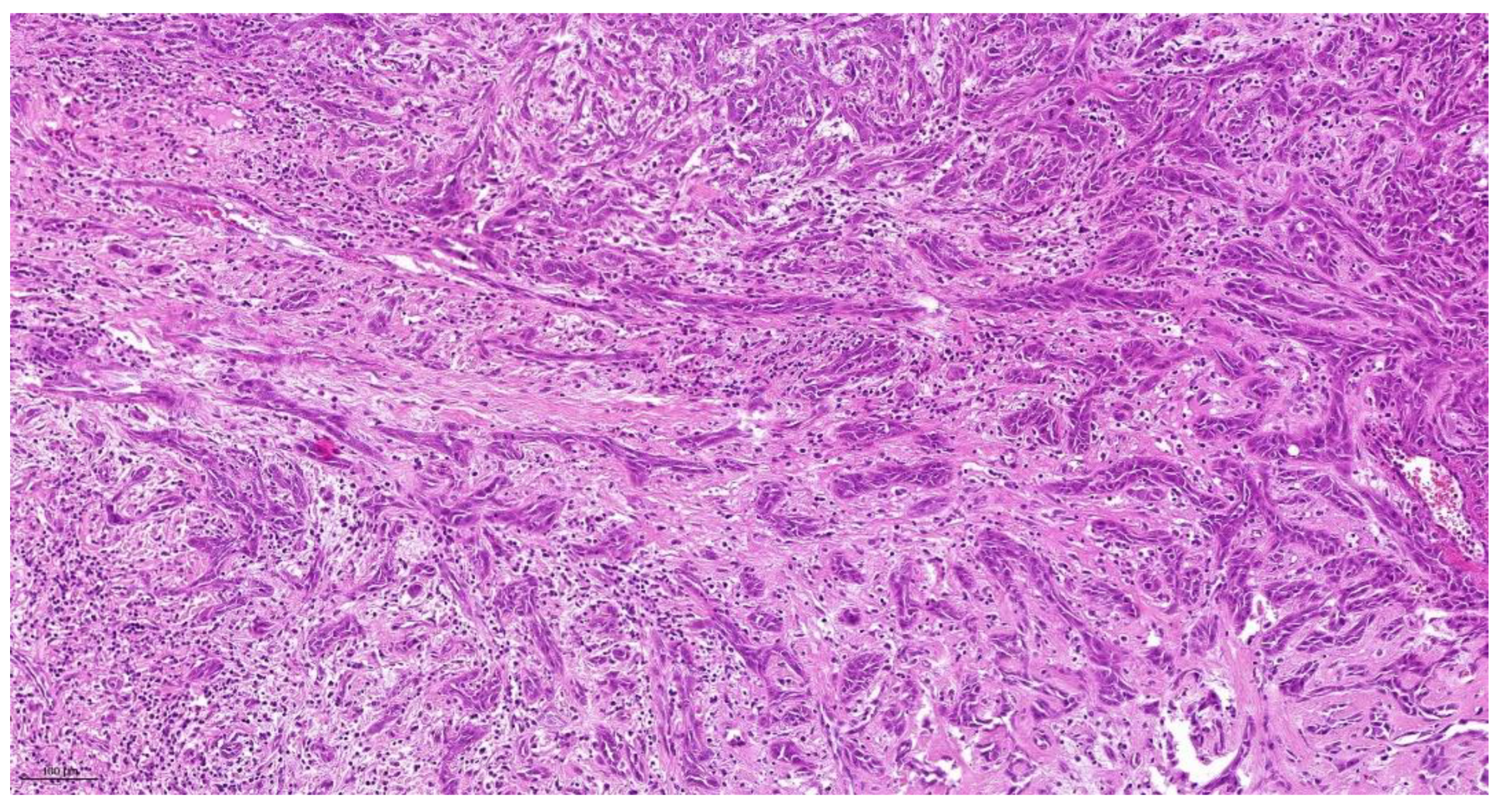 Cancers 14 04949 g003 Cancers 14 04949 g003